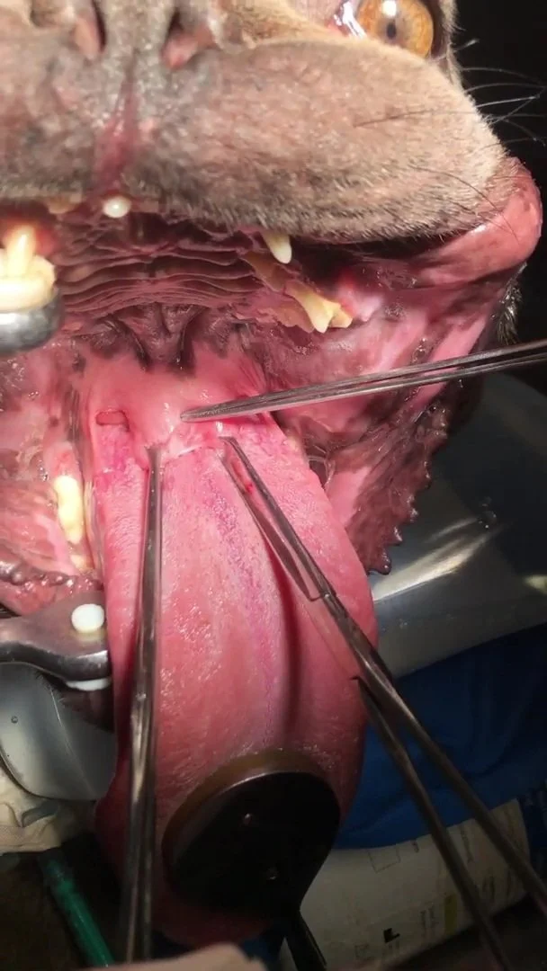 Gaumensegel Operation