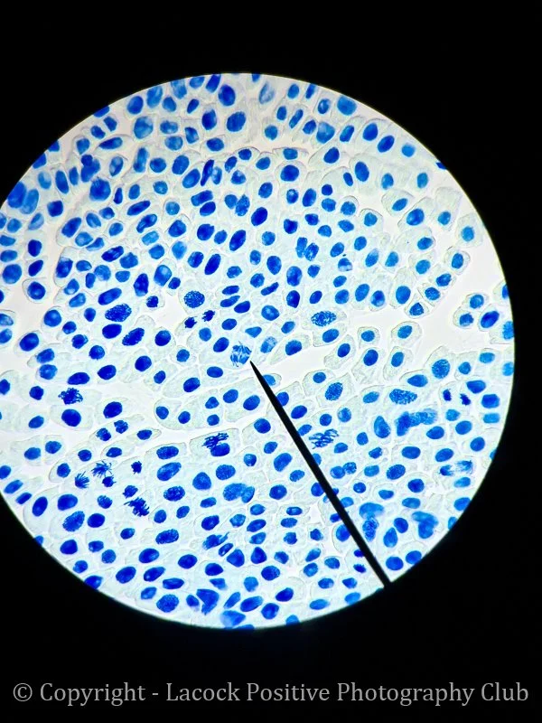Lesley-Macro1-Mitosis-Onion root tip.jpg