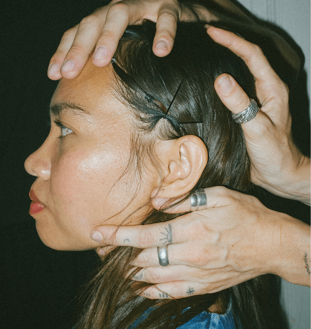 A woman with dark hair receiving a scalp acupuncture treatment from a practitioner.
