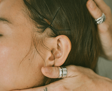 A person receiving an ear acupuncture treatment, with thin needles inserted into the earlobe and surrounding areas.