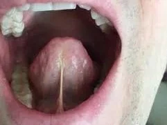 Myofunctional therapist assessing tongue tie and providing therapy for optimal oral health in Sault Ste. Marie