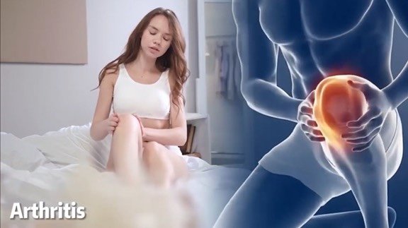 A young woman sitting on a bed holding her knee next to a digital medical illustration of a person with a highlighted inflamed hip joint, labeled 'Arthritis'.