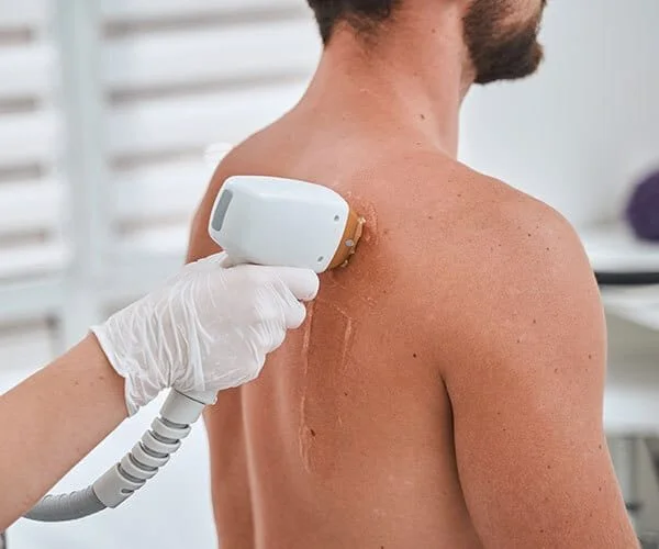 Épilation laser homme à Orange — LumiLys cabinet médical