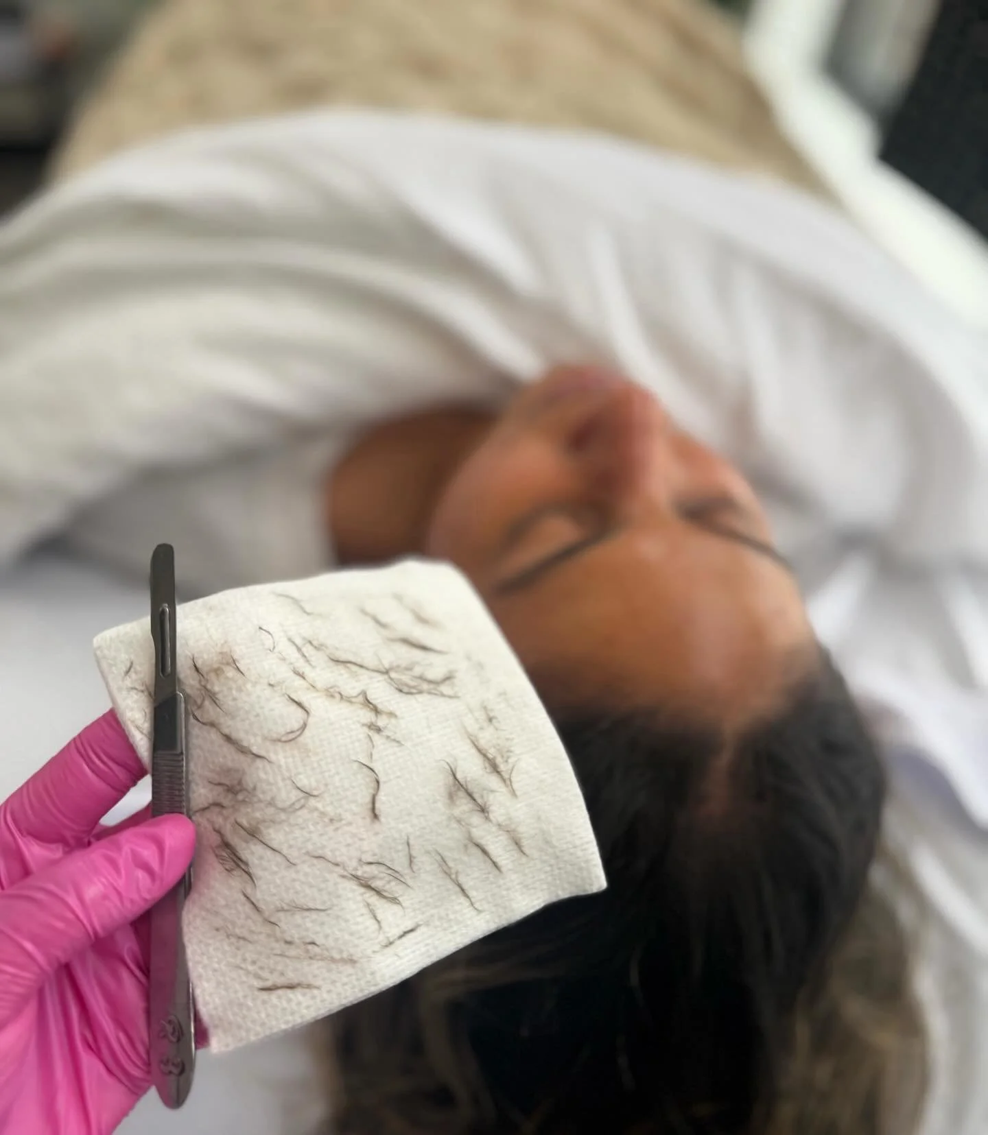 Dermaplane > everything

#esthetician #dermaplane #facial #silkcoaesthetics