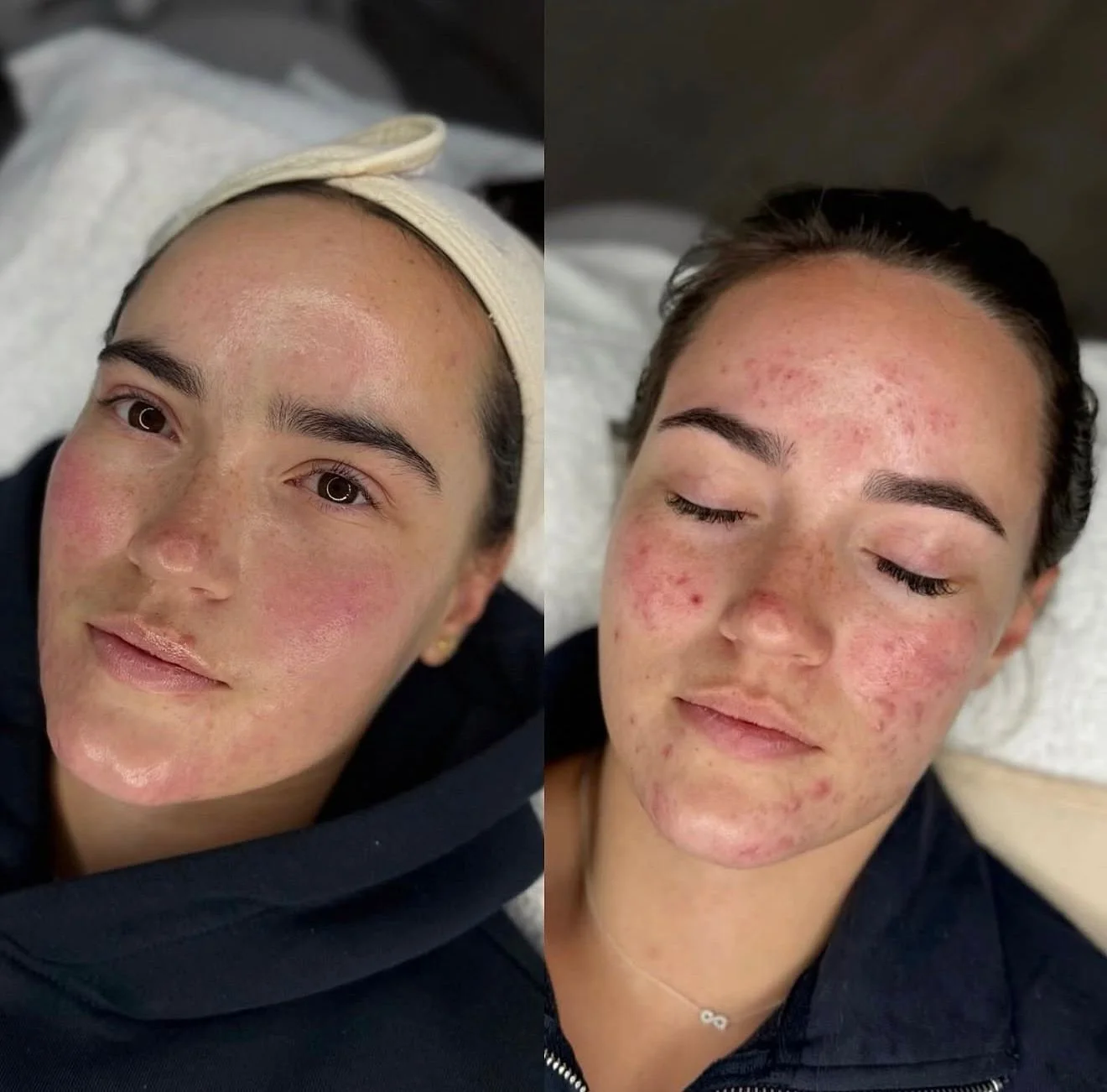 How to Repair a Damaged Skin Barrier Fast – Expert Tips from a Skin Specialist