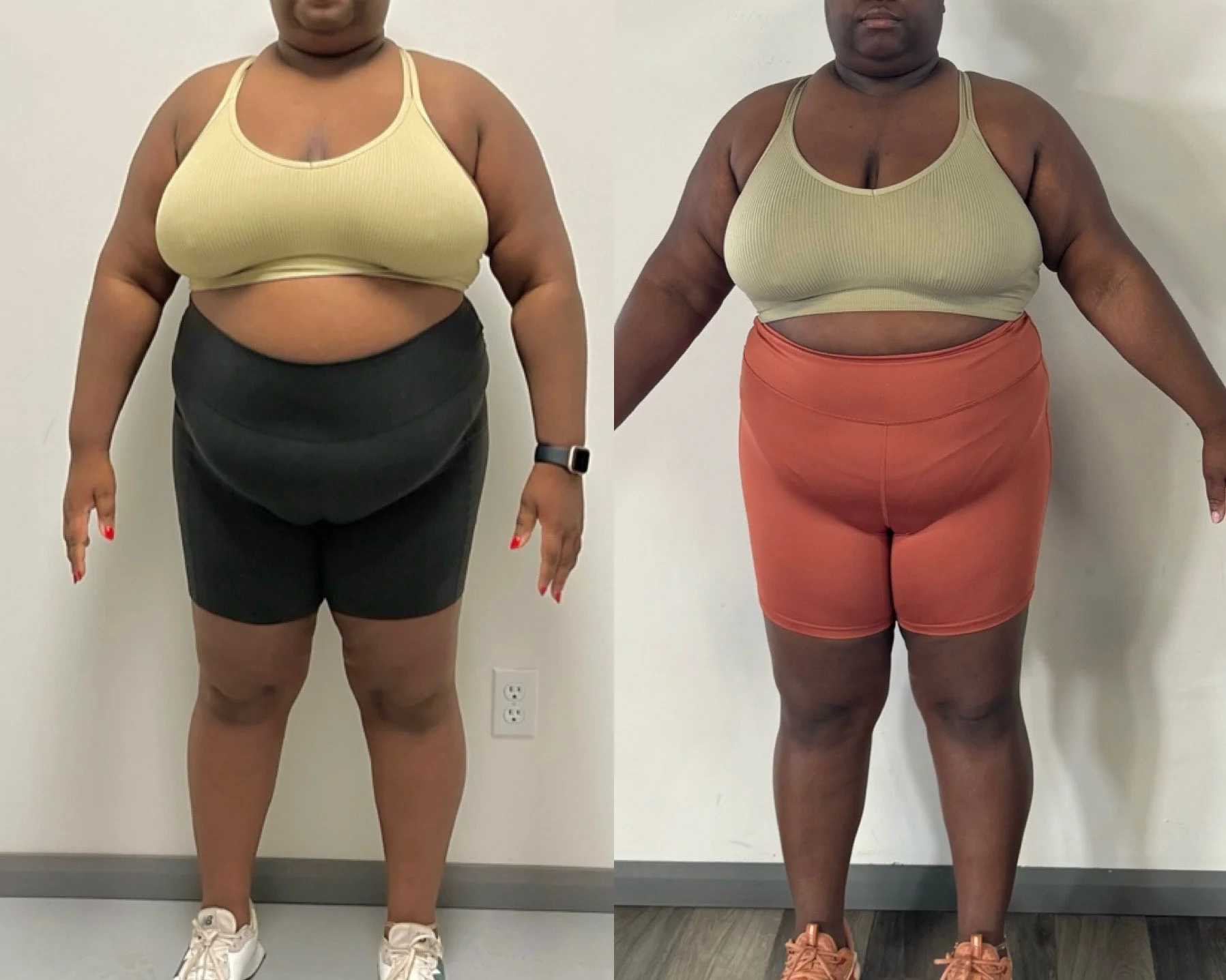 Side-by-side comparison of a women showing weight loss progress.
