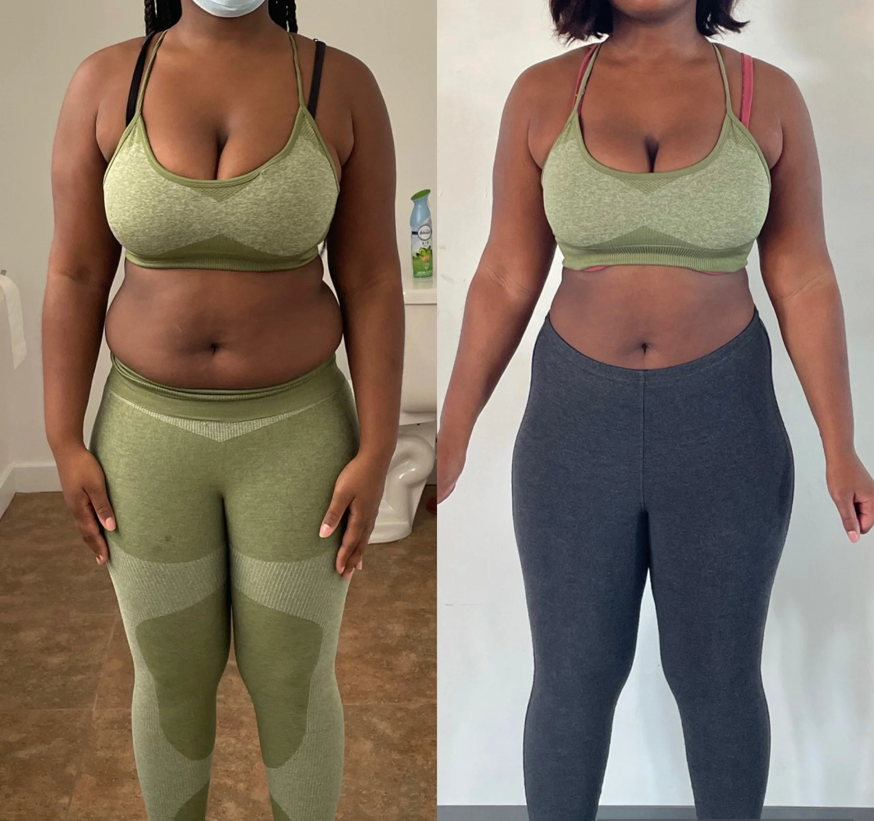 Side-by-side comparison of a women showing weight loss progress.