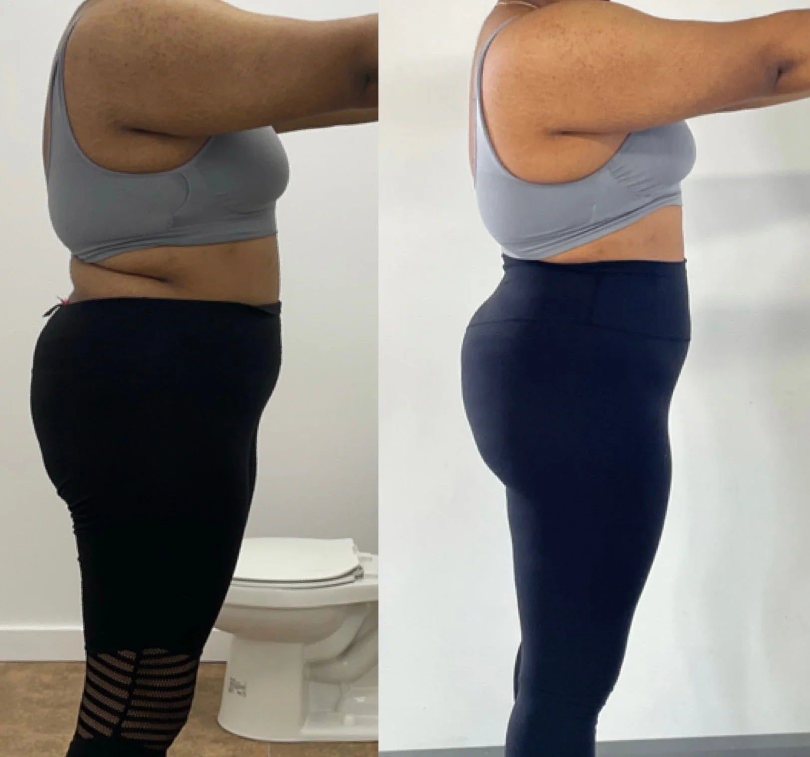 Side-by-side comparison of a women showing weight loss progress.