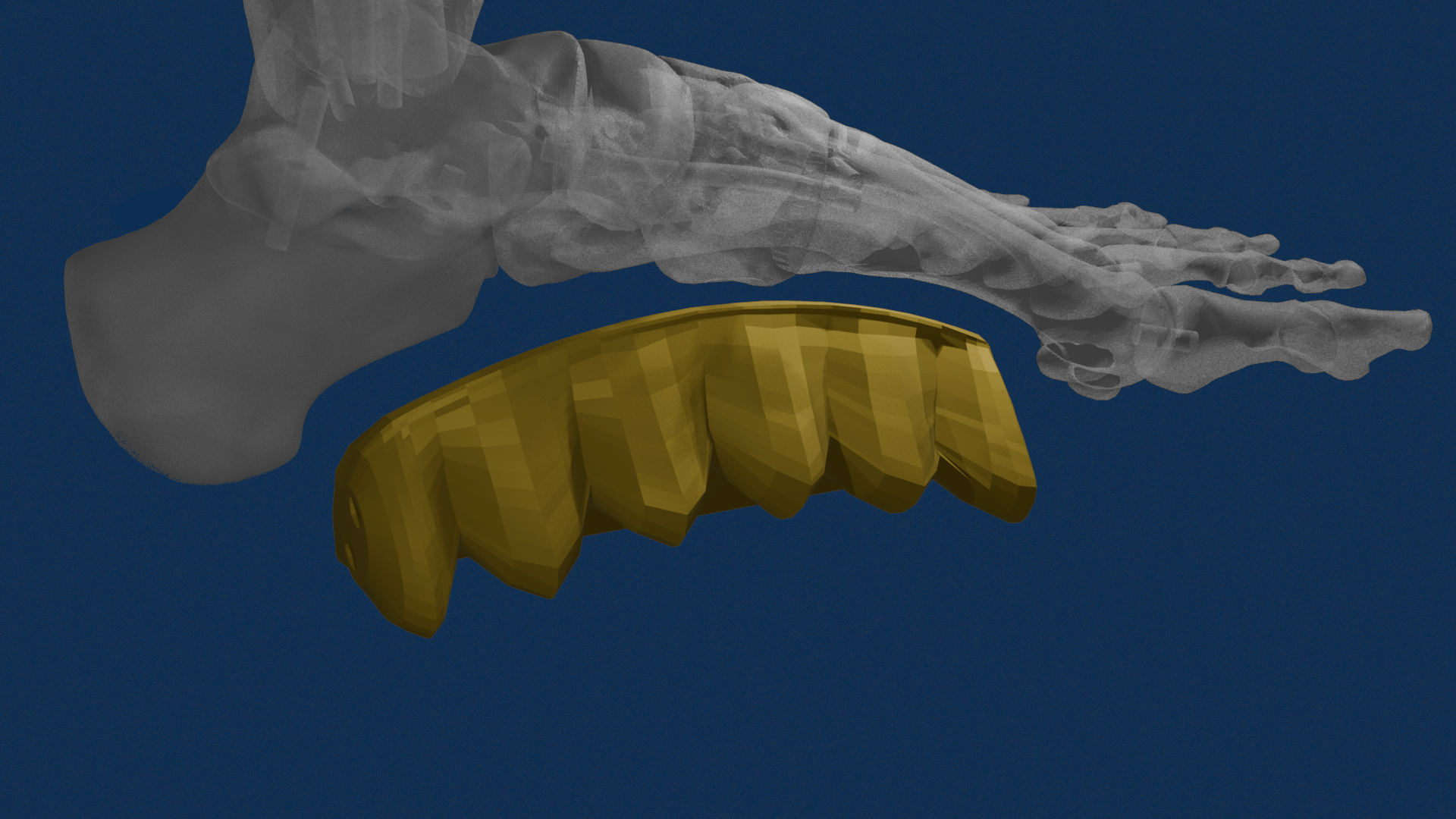 3D illustration of a human skull with a missile-like object in yellow in front of it against a dark blue background.