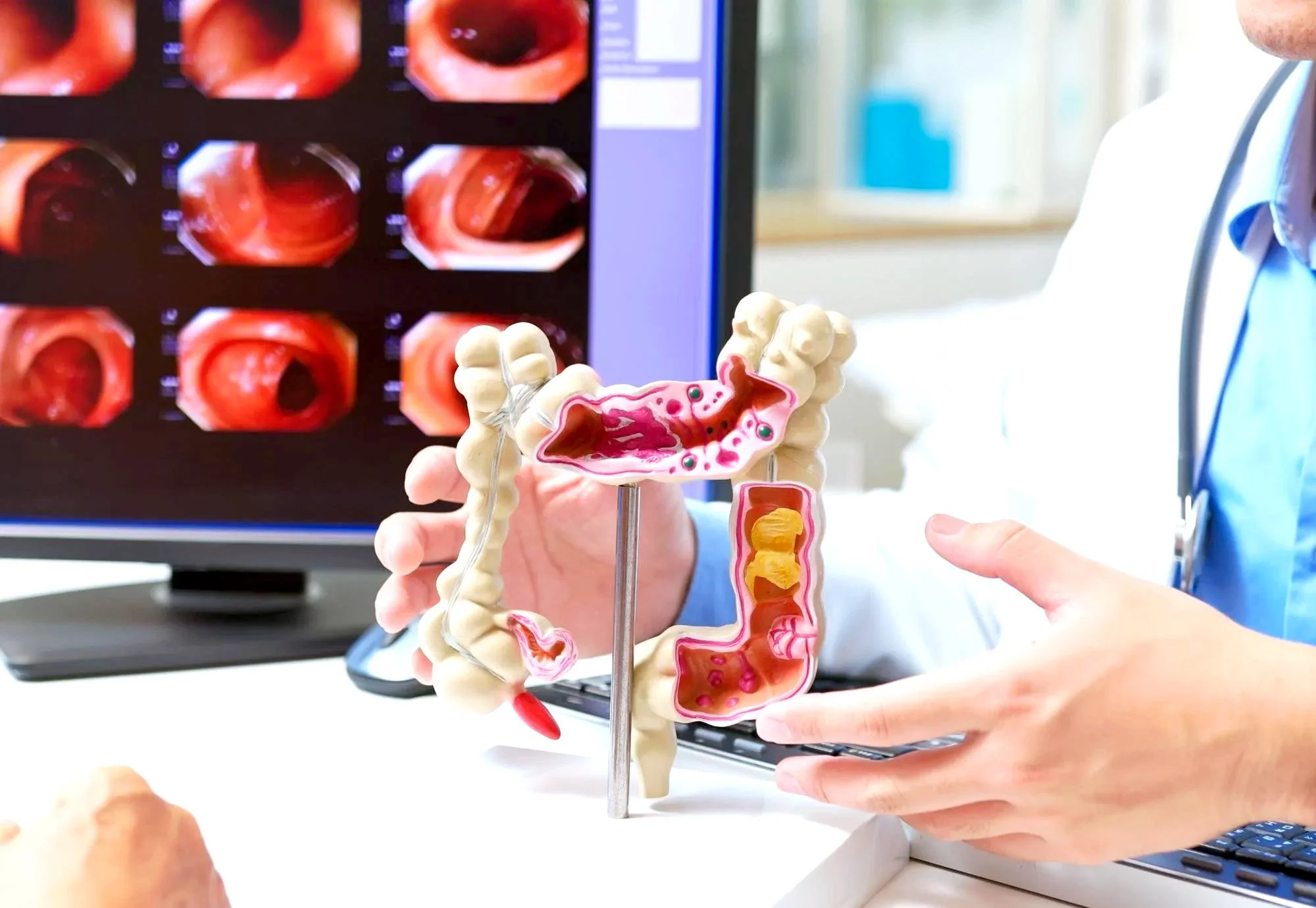 Medical professional demonstrating and holding a model of human digestive system in front of a computer displaying colon images.