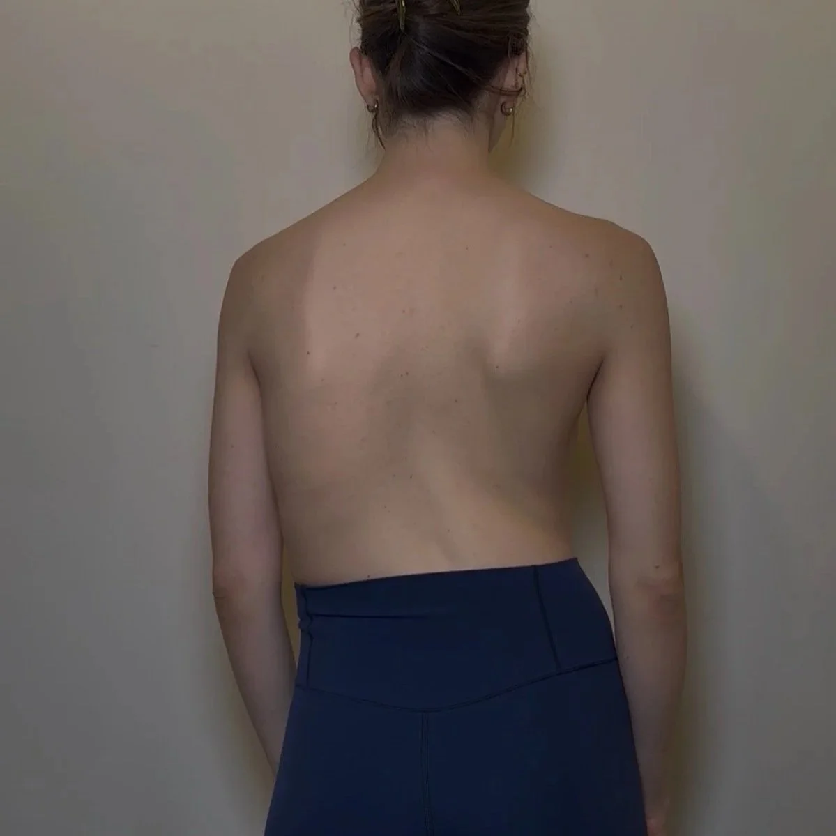 October REFORMER PILATES WITH SCOLIOSIS 