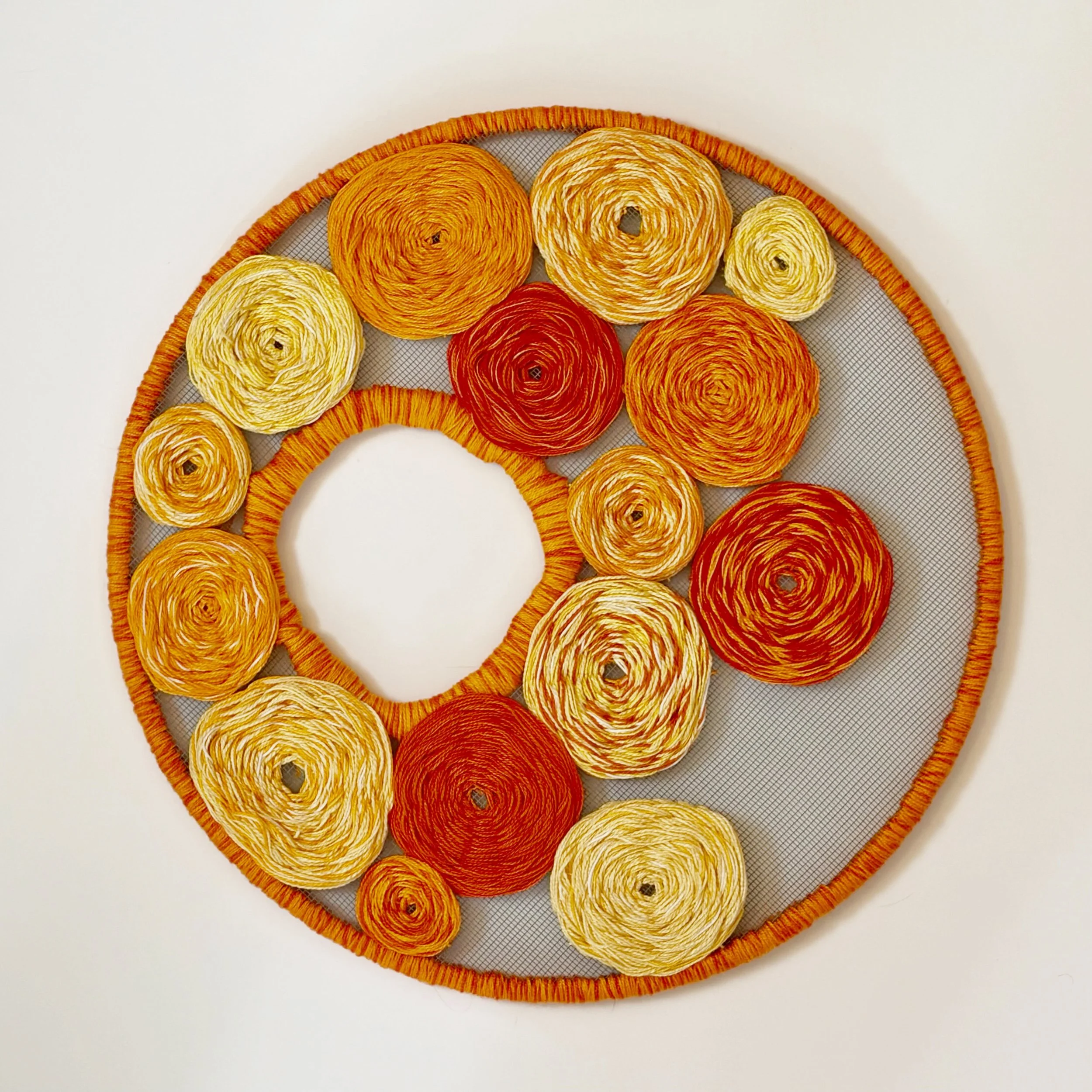 Pulmonary alveolar proteinosis 2024 14"