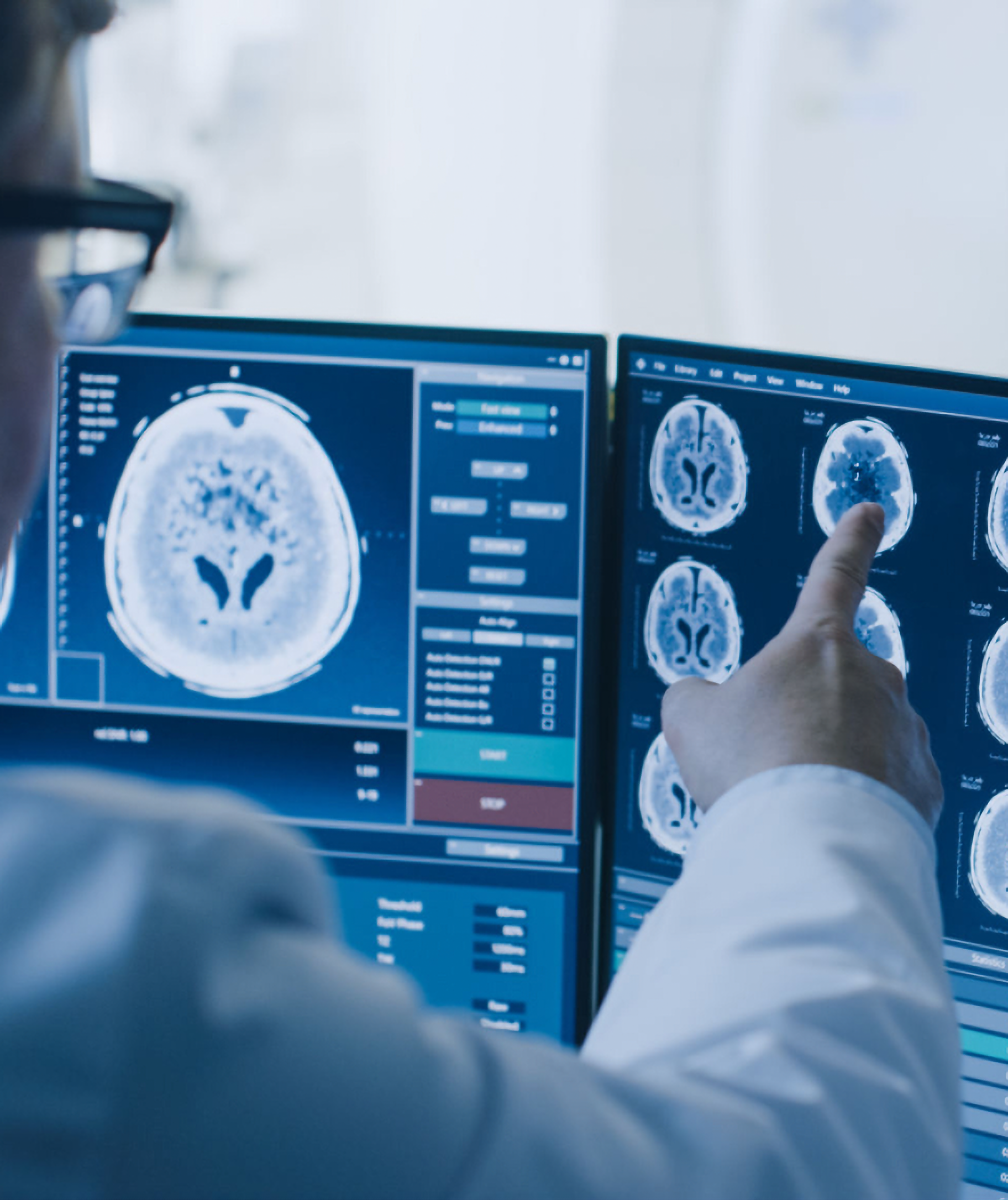 A medical professional examining brain MRI scans of strokes.