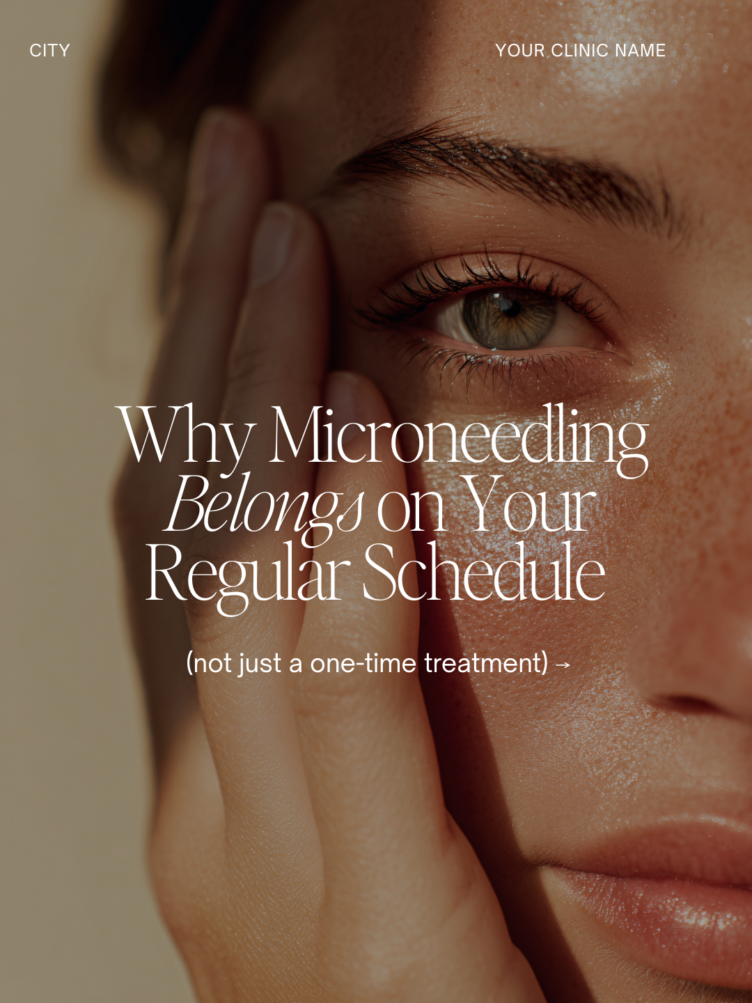 Carousel - This is Why Microneedling Belongs on Your Regular Schedule .png