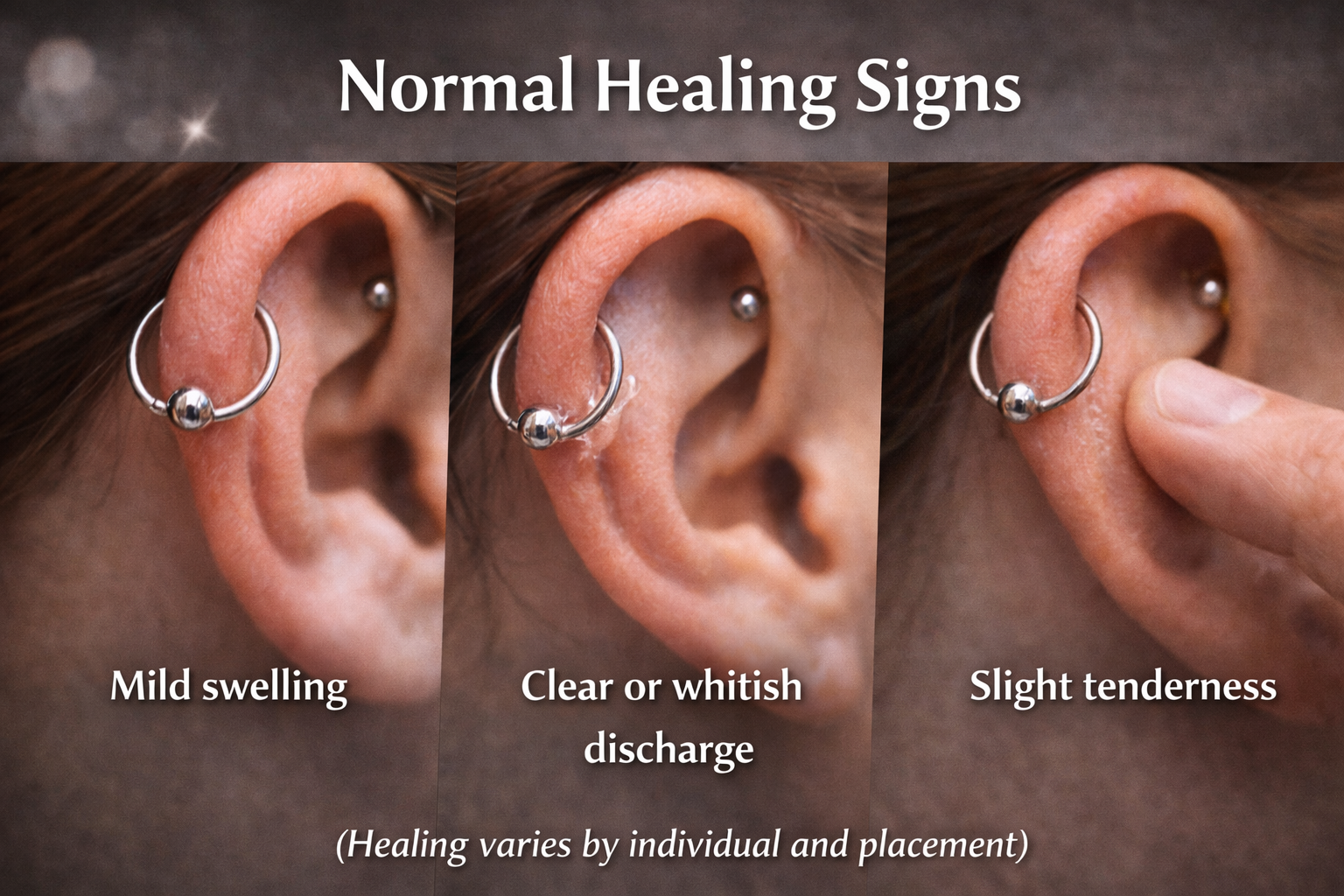 Normal piercing healing signs including mild swelling clear discharge and tenderness.png