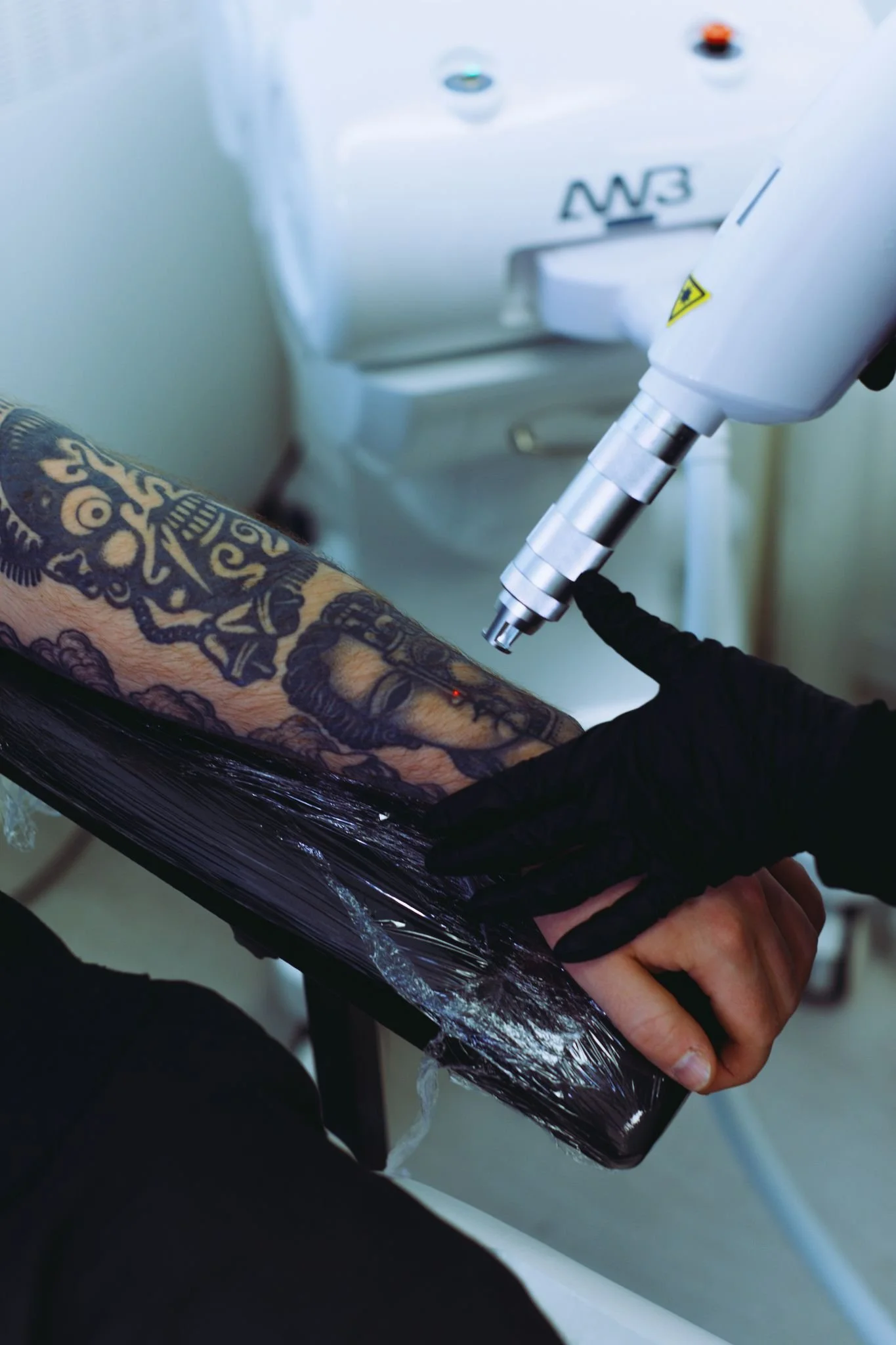 Cheltenham, Gloucestershire, private and discreet, tattoo removal studio, specializes in laser tattoo removal, tattoo fading, advanced technology to safely and effectively remove unwanted tattoos.