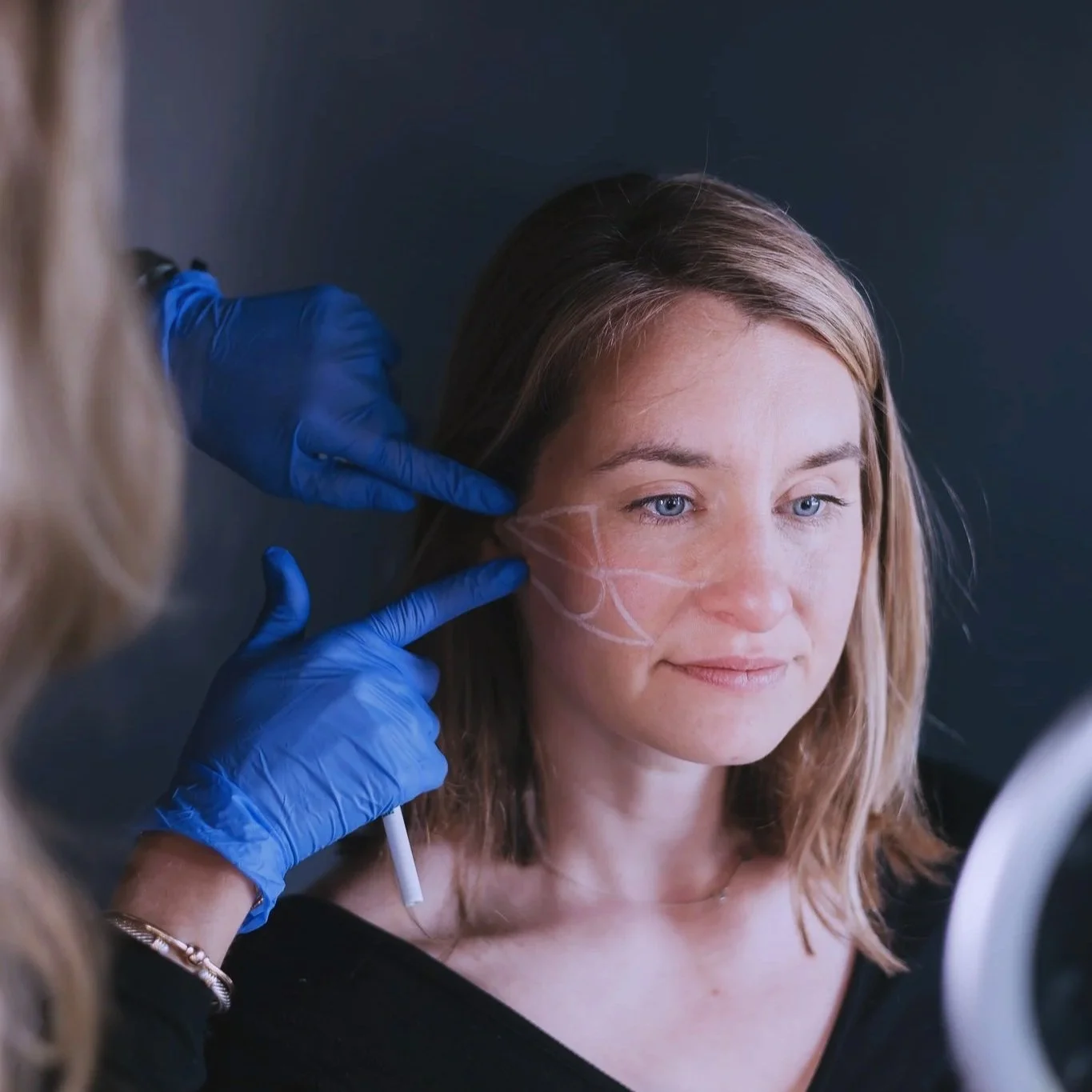 A woman with light brown hair and blue eyes getting a cosmetic tattoo procedure on her face involving a stencil and fine lines, while a technician wearing blue gloves applies the design.