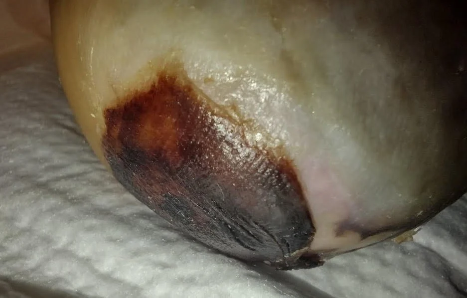 foot ulcer and wound care dewitt iowa 