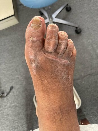 wound care doctor dewitt iowa podiatrist