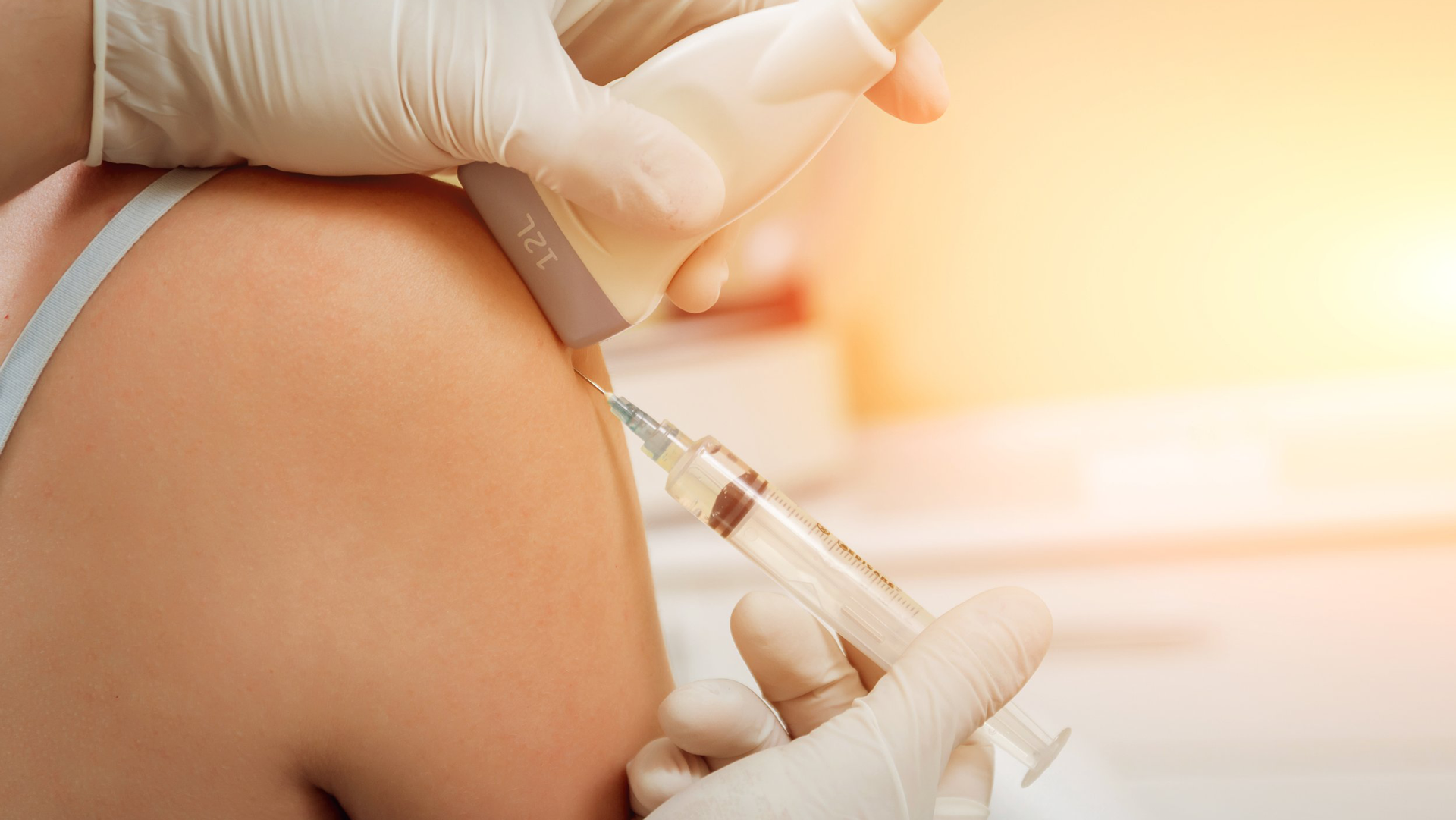 A person wearing gloves administers an ultrasound guided injection into another person's shoulder.