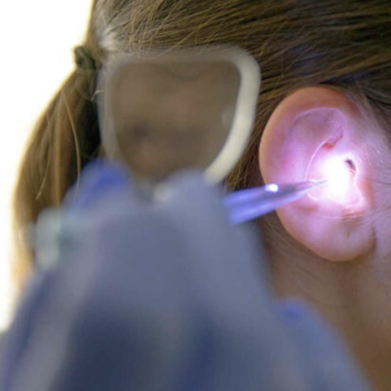 ADDITIONAL WAX REMOVAL TECHNIQUES