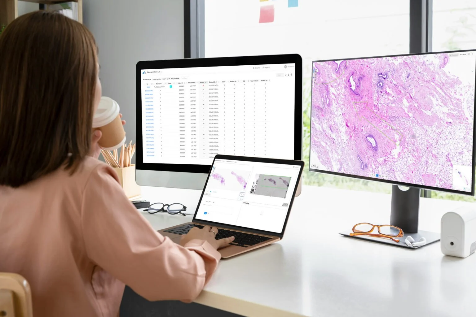 Pathologist reviewing WSI