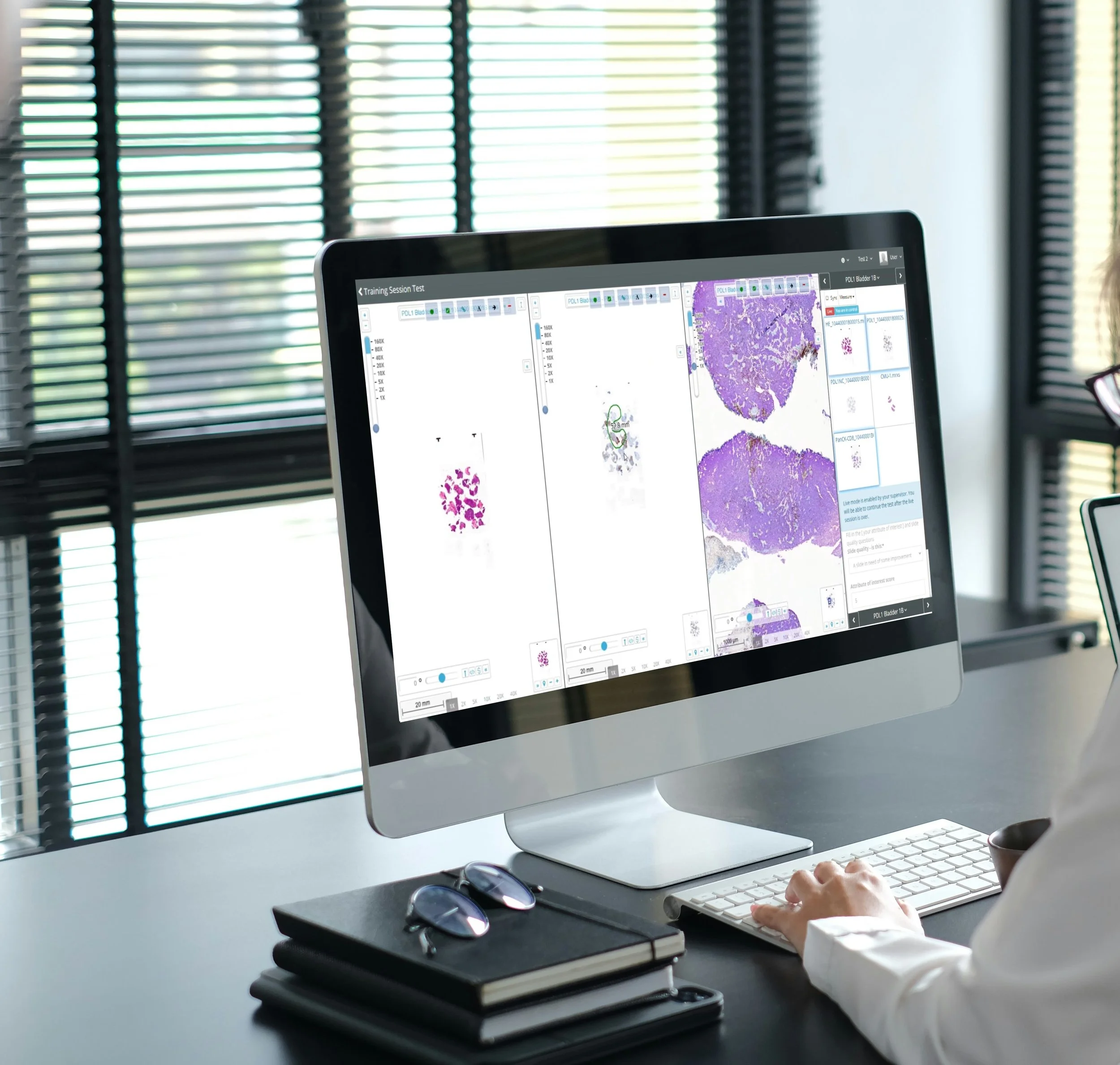 Performing EQA and Ringtrials