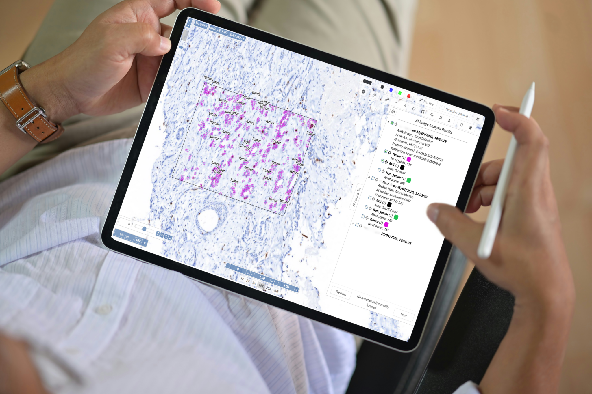 Ai algorithms analyzing WSI in the cloud or local