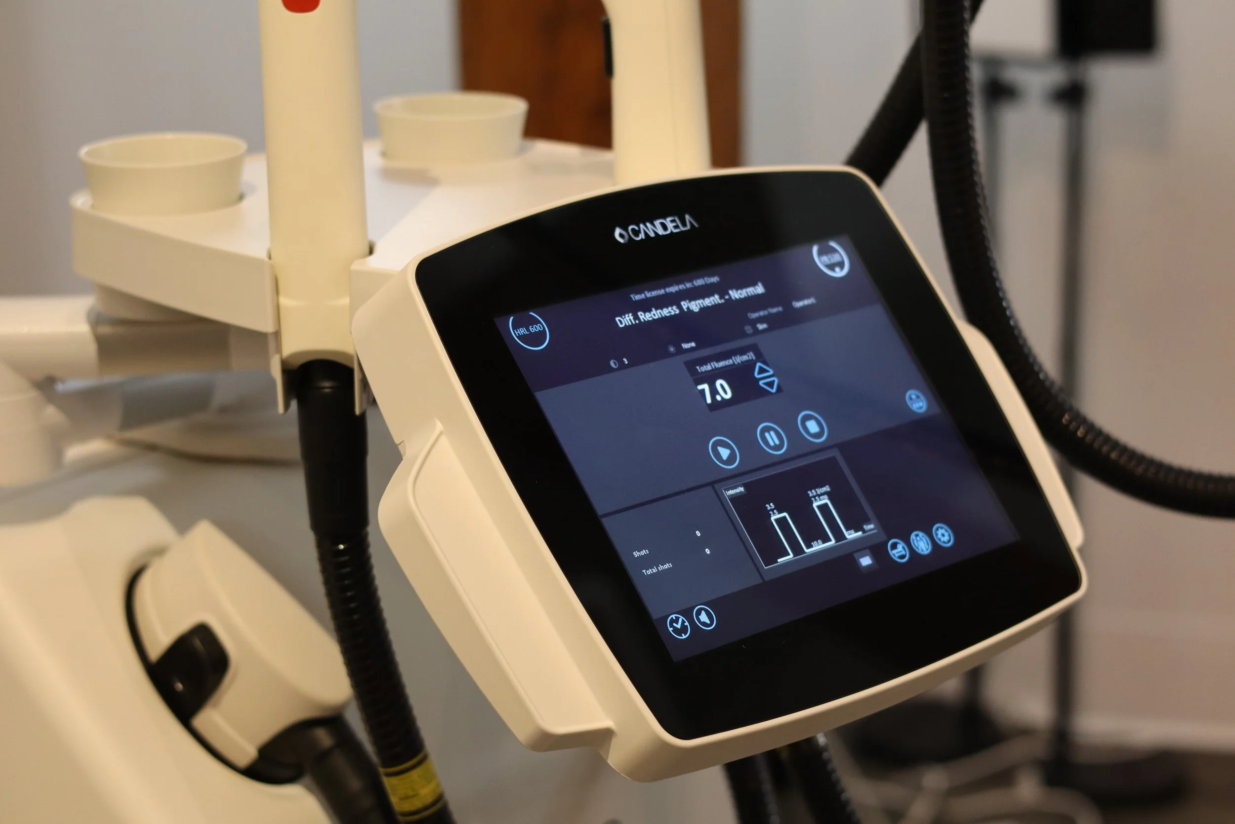 Medical device with touchscreen display showing analysis results, connected with hoses and placed on a stand, likely used for laser skin treatment.