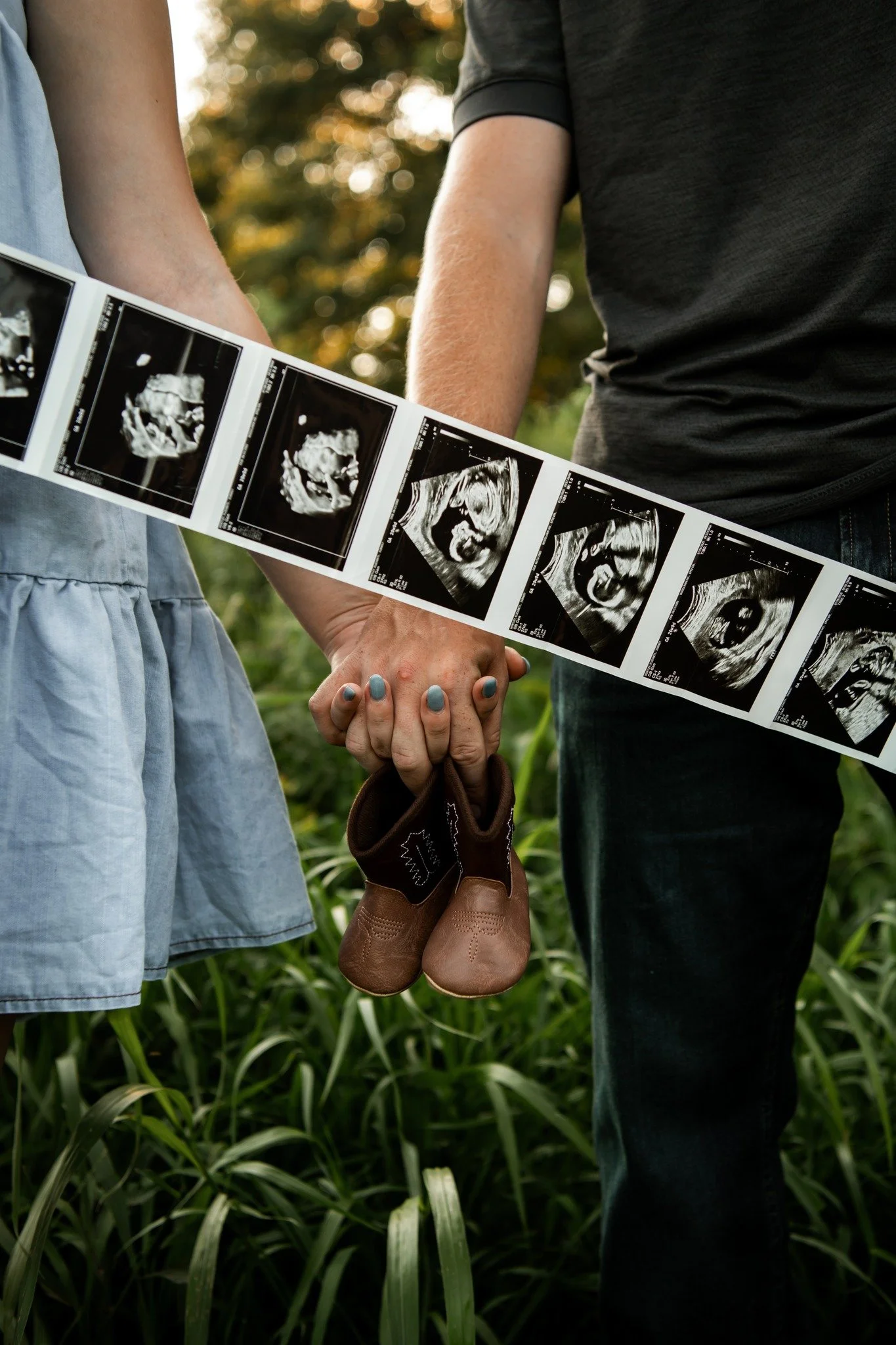 A couple holding hands in a grassy outdoor setting, with a strip of ultrasound images and small baby shoes hanging from their joined hands.