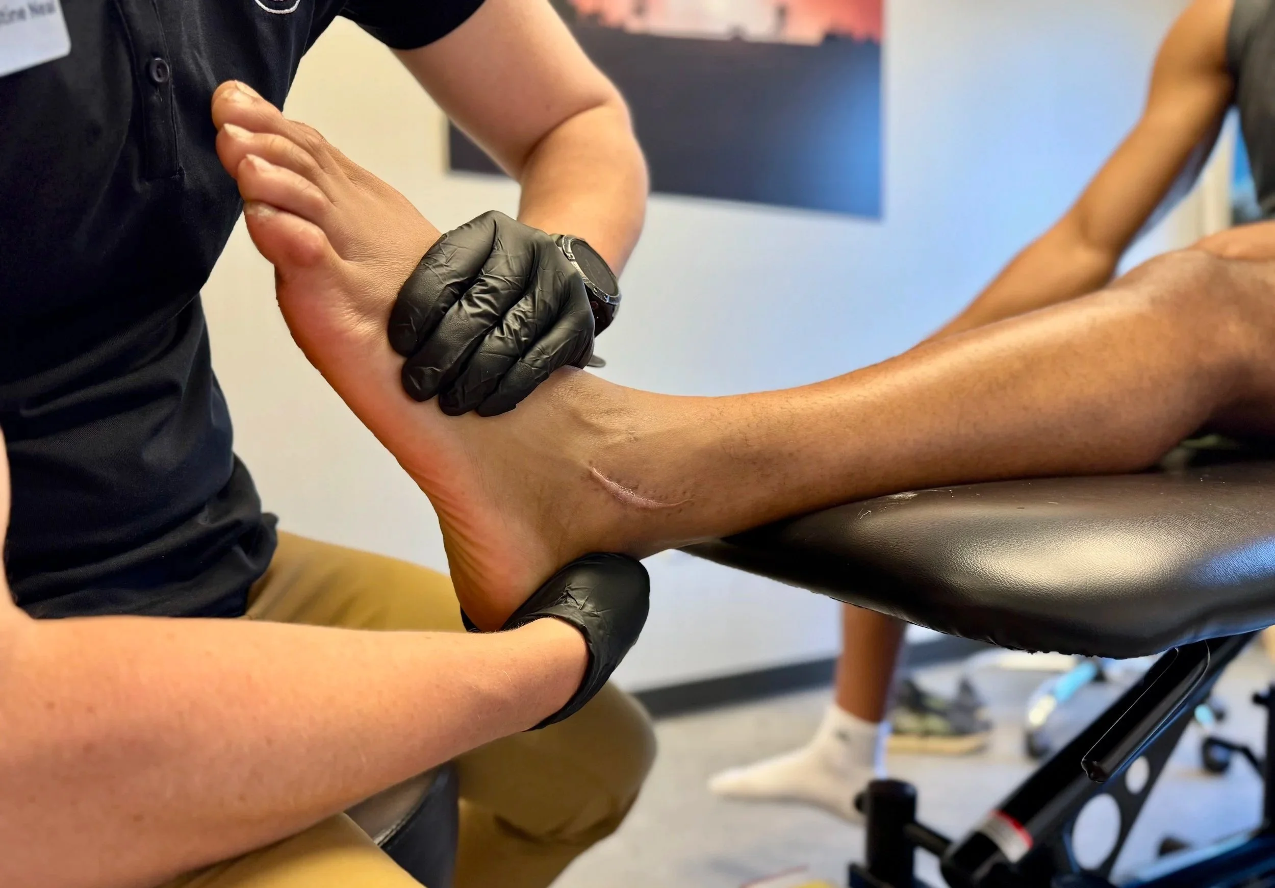 Physical therapist examining a person's ankle and foot, who is lying on a therapy table, with a scar visible on the lower leg.