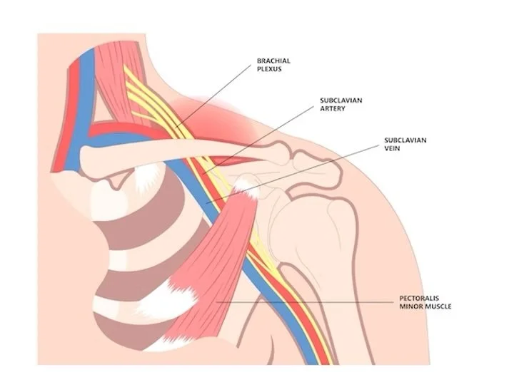 brachial plexus