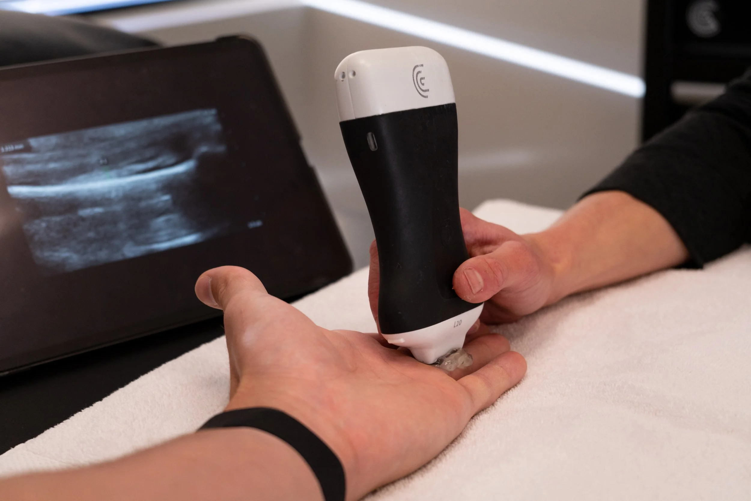 finger ultrasound