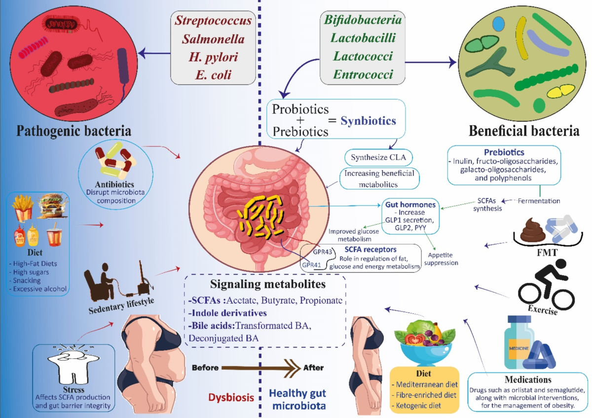 How Your Gut Bugs Influence Productivity, Fat and Weight Loss