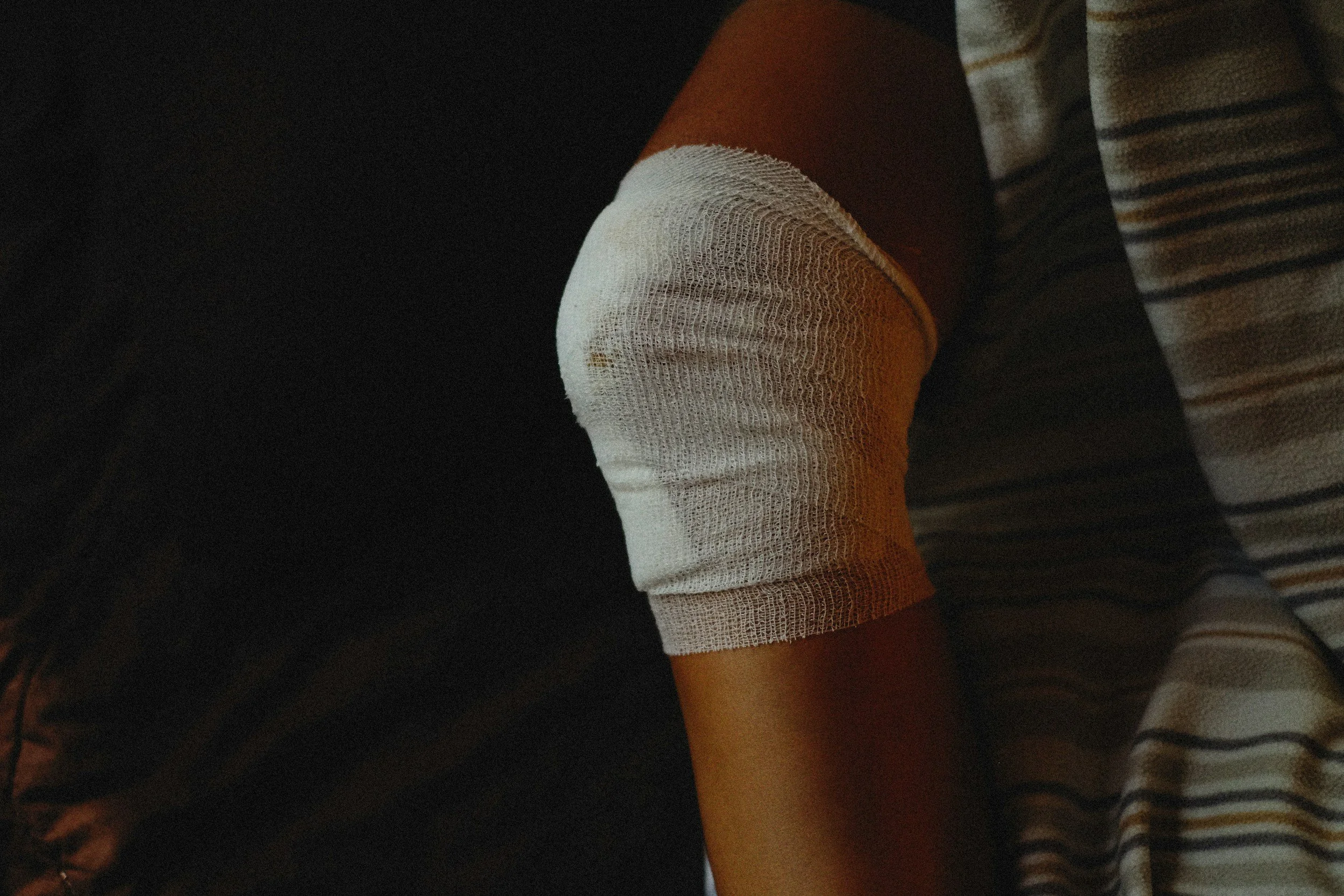 A person's arm resting on a striped fabric surface, with a white bandage wrapped around the elbow.