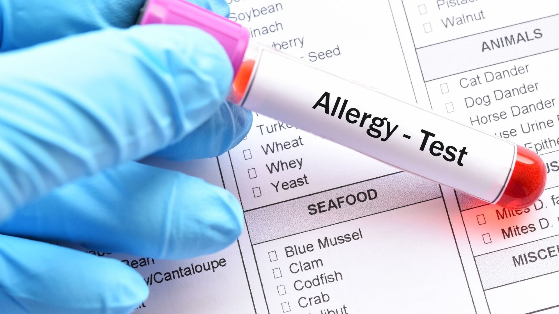 Person wearing blue gloves holding a blood sample labeled 'Allergy - Test' over a form with allergy checklist and food categories.