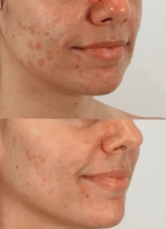 Medspa Services in Astoria, NY, 11103