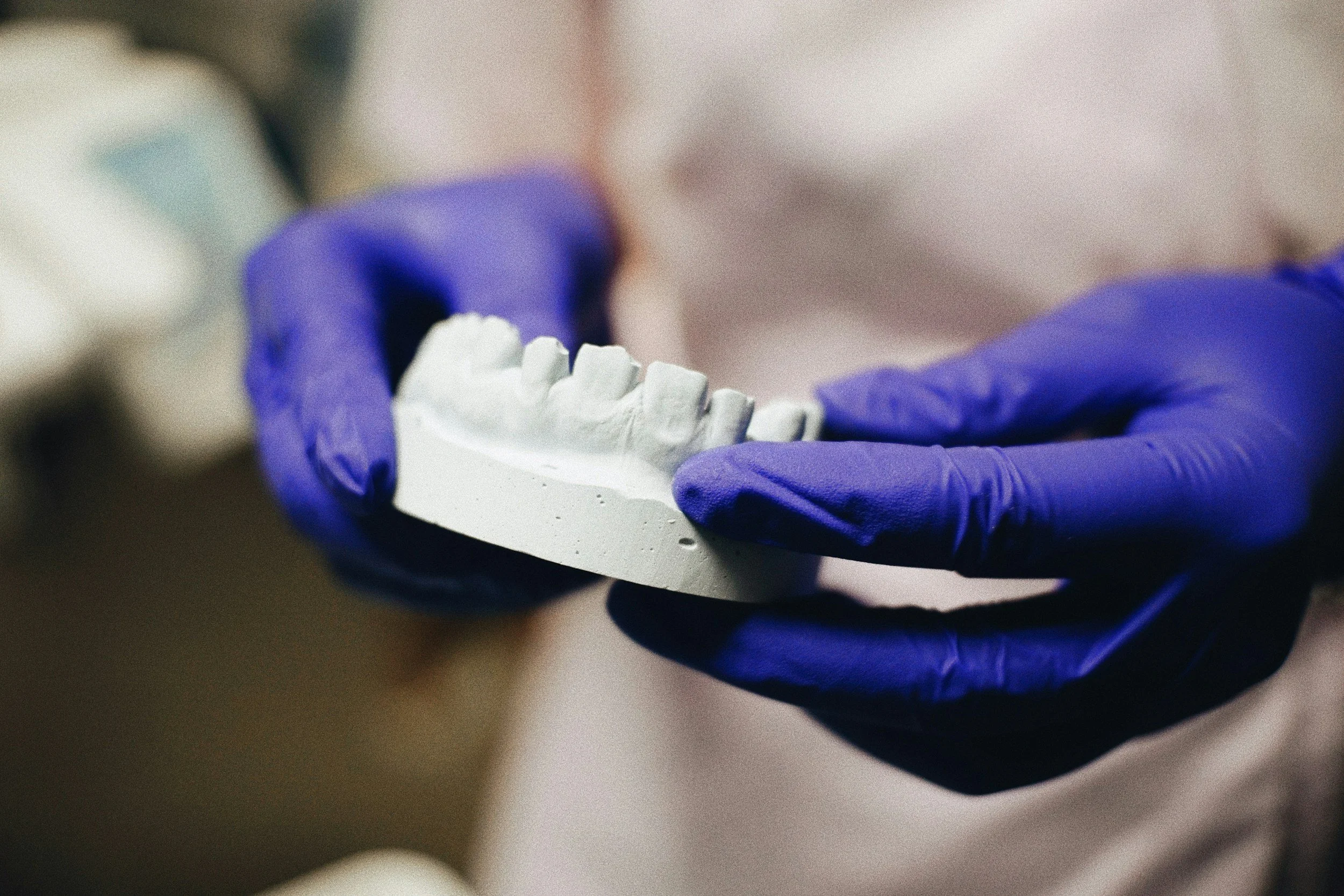 A person wearing purple gloves holding a white dental mold.