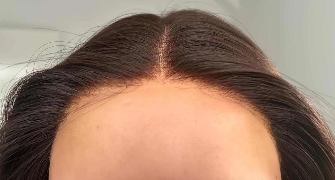 Close-up of a woman's forehead and hair, showing well-groomed, smooth skin and shiny brown hair parted in the middle. No visible signs of wig knots.