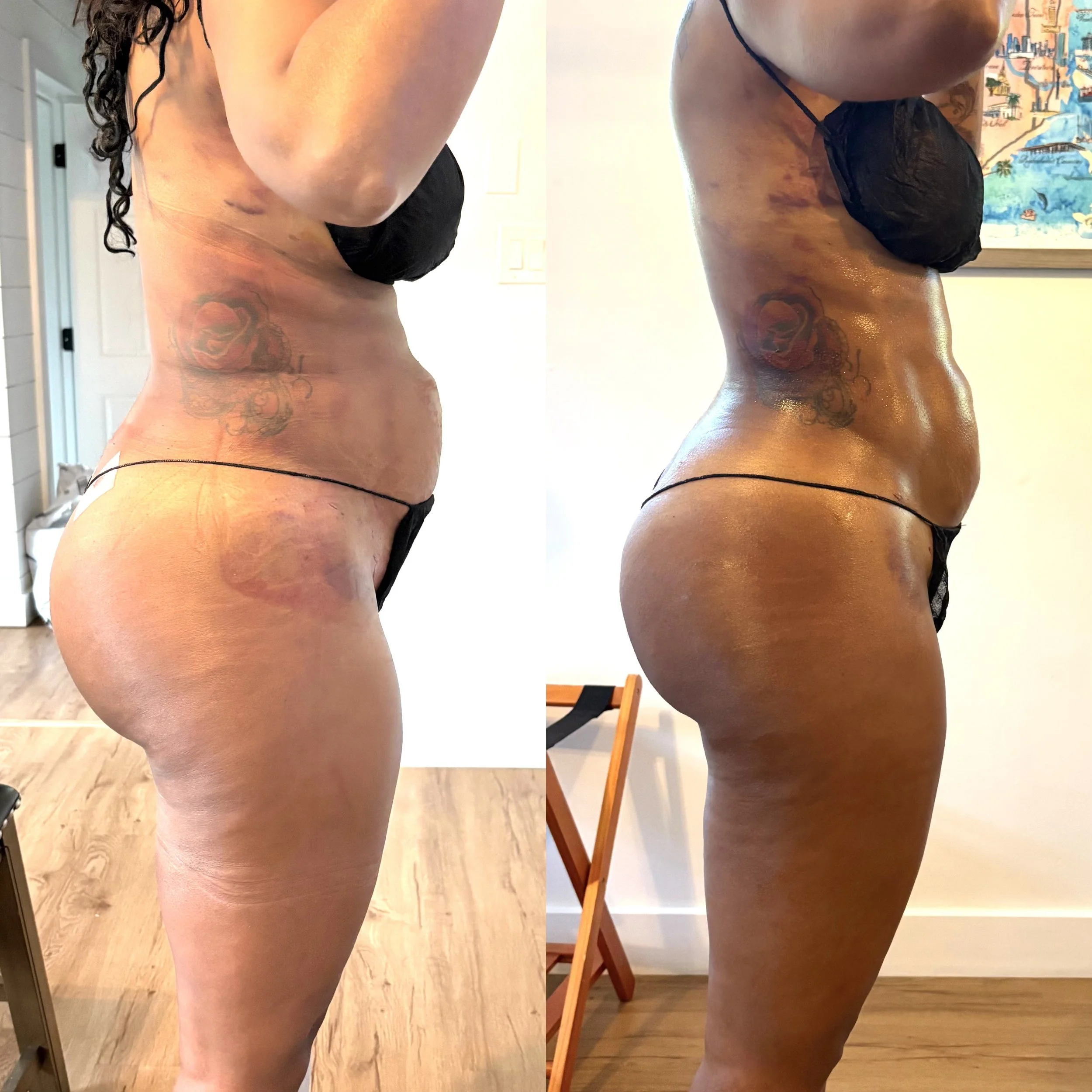 Side-by-side comparison of a woman's body before and after skincare or body treatment, highlighting differences in skin texture and appearance.