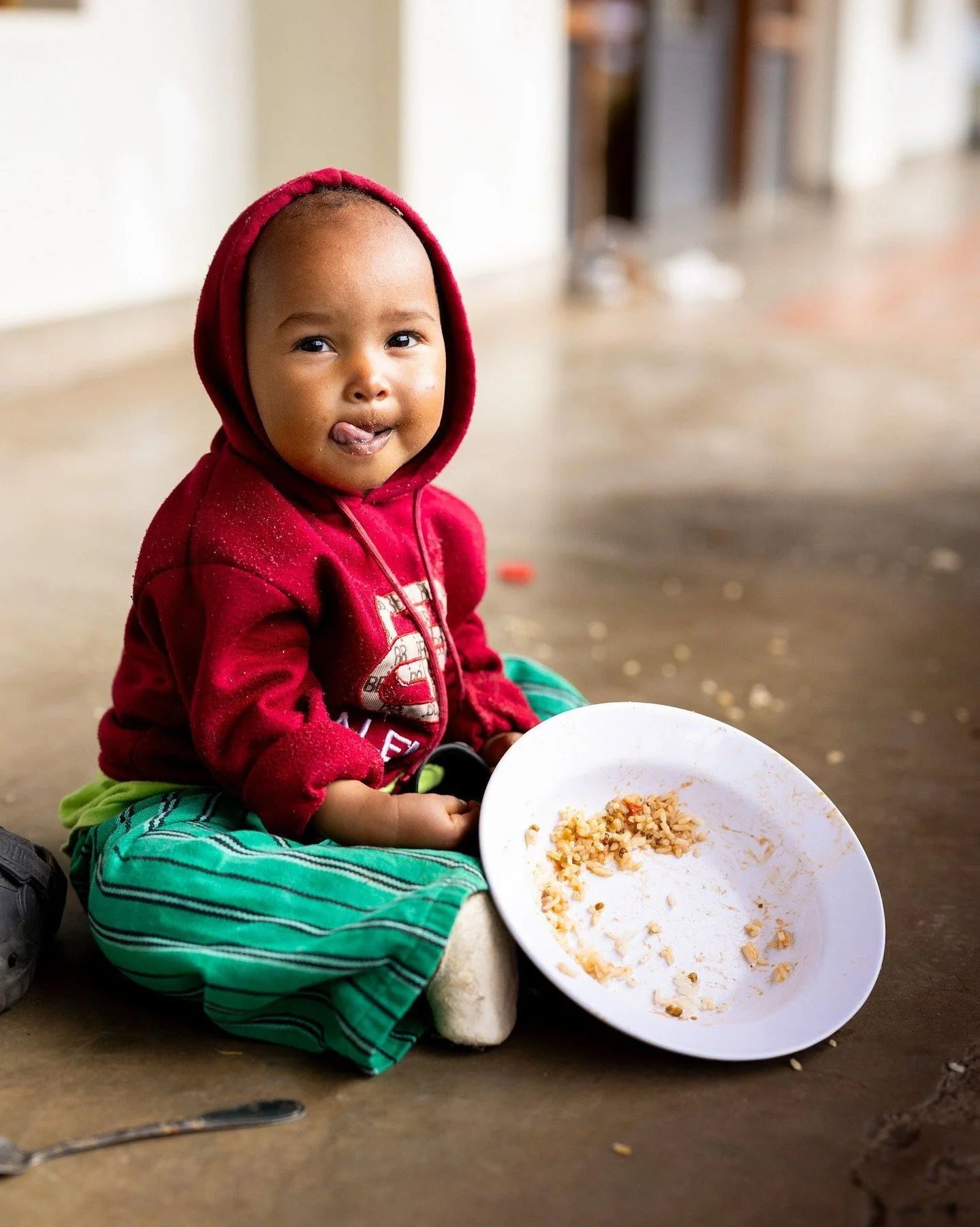 Our &lsquo;Surgery Strong&rsquo; therapeutic feeding programme is a clinical intervention designed to boost children&rsquo;s nutrition to prepare them for surgery and give their post-operative recovery the best possible chance.