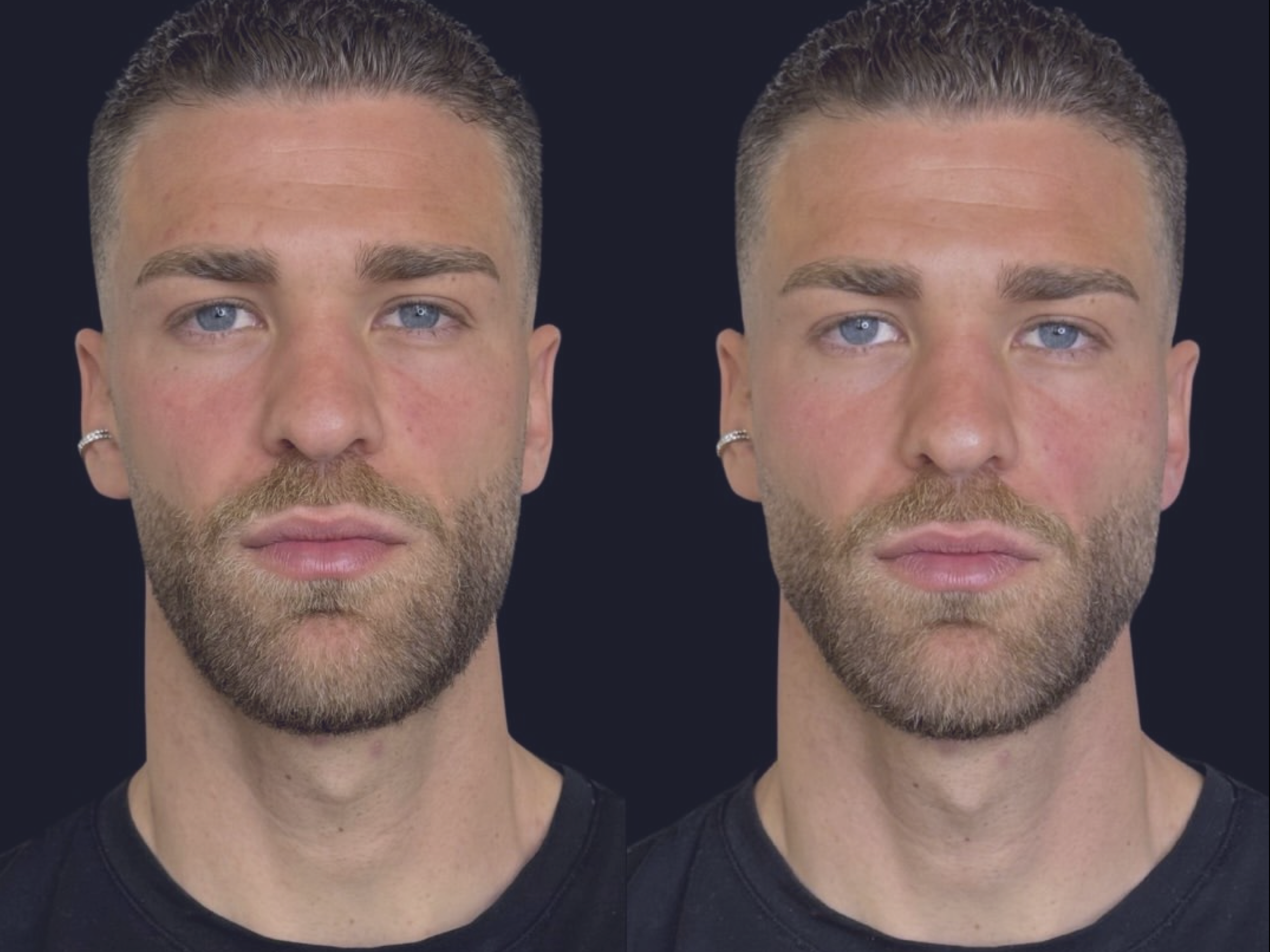 DR. LUDOVICO PALLA: Looksmaxxing, Male Beauty Standards and the Truth About Cosmetic Surgery