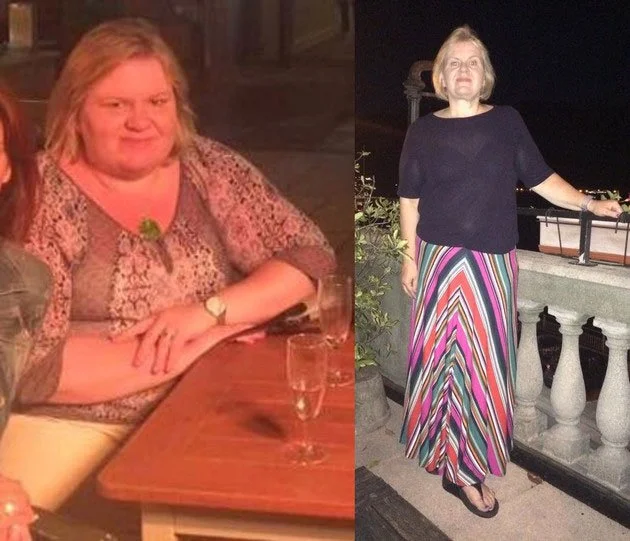 Before and after weight loss success