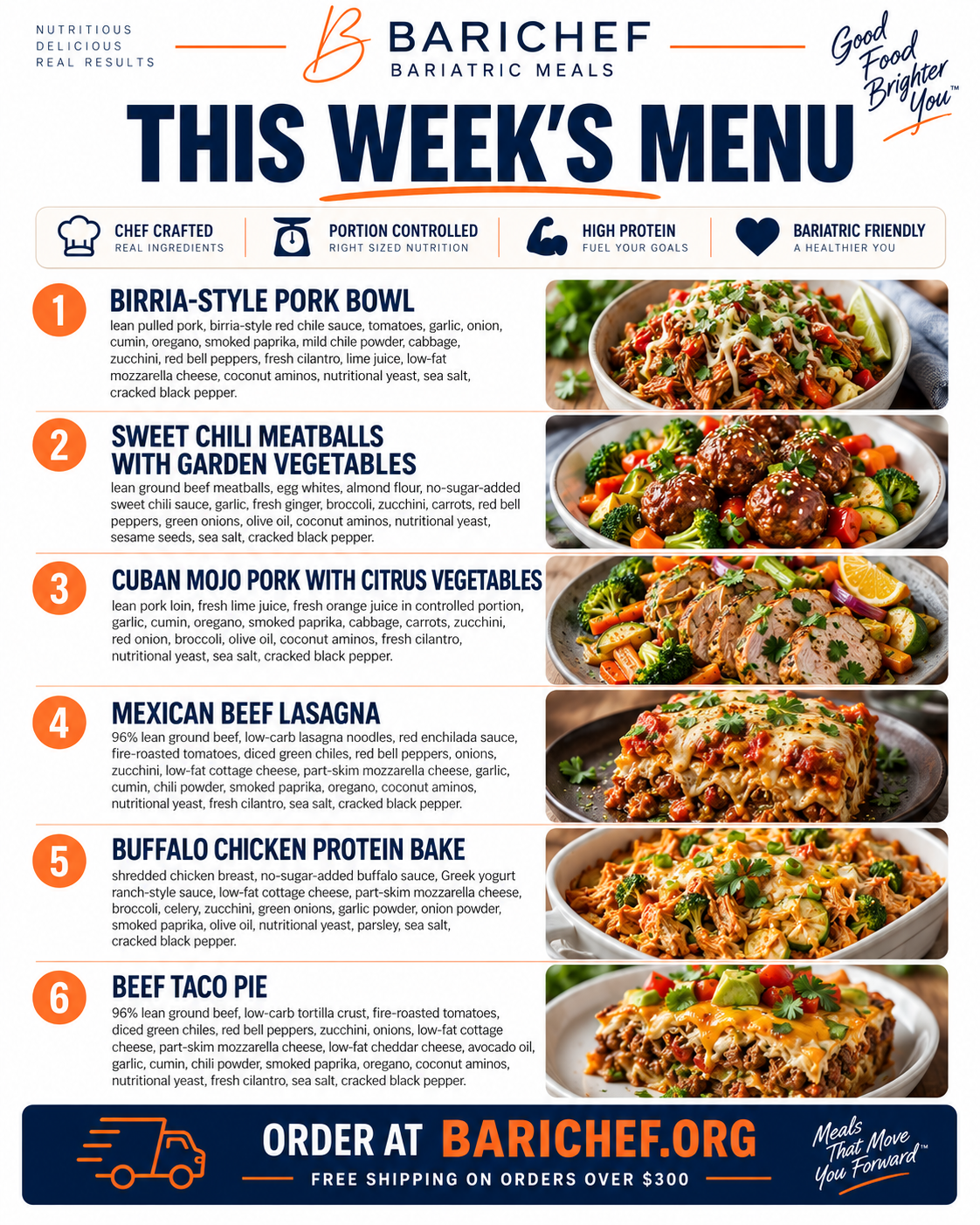 BariChef~Build Your Own Box - WLS/VGS Support Plan