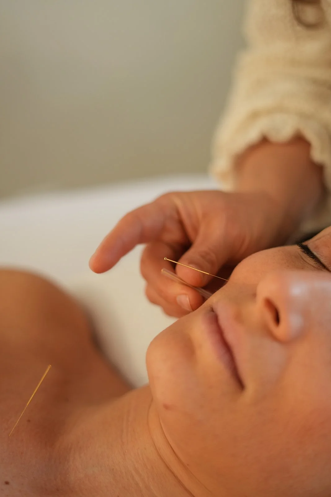 First Access: Facial Acupuncture Series