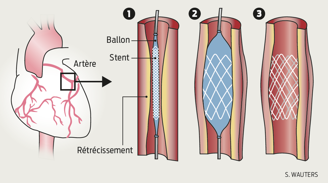 Capture d’écran 2026-02-12 à 15.41.17.png