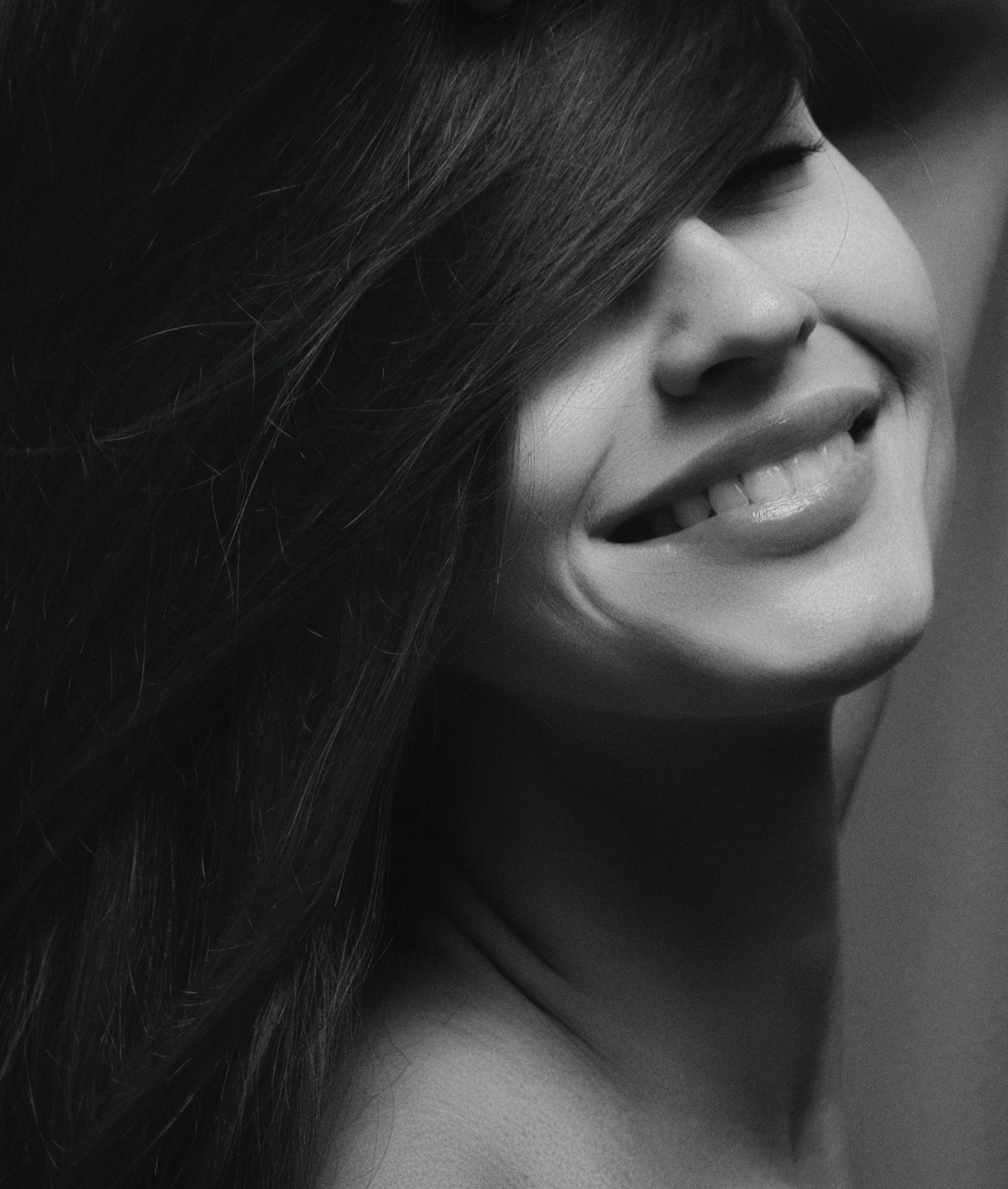 Black and white close-up photo of a woman smiling naturally, demonstrating smooth skin and expressive facial aesthetics from premium Dysport and Jeuveau wrinkle treatments at RAW Rejuvenation in Chambersburg PA.