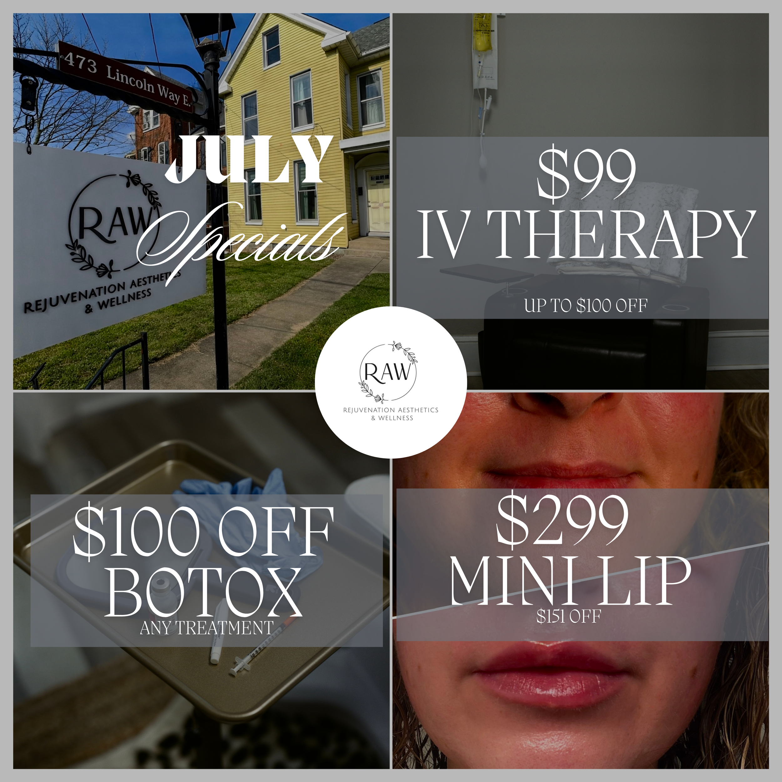 Monthly med spa specials at RAW Rejuvenation Aesthetics & Wellness in Chambersburg PA featuring ninety-nine dollar IV therapy, one hundred dollars off Botox neuromodulator injections, and a two hundred ninety-nine dollar mini lip filler treatment.