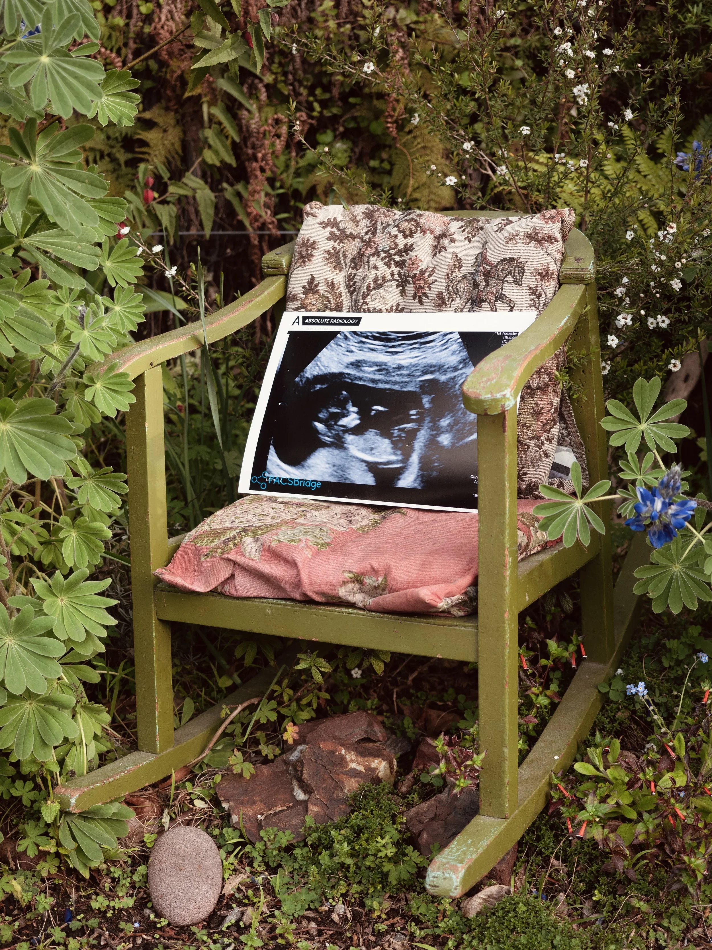 Psychological support for fertility challenges and infertility – Kaitlin Allen, New Zealand Fertility Counsellor