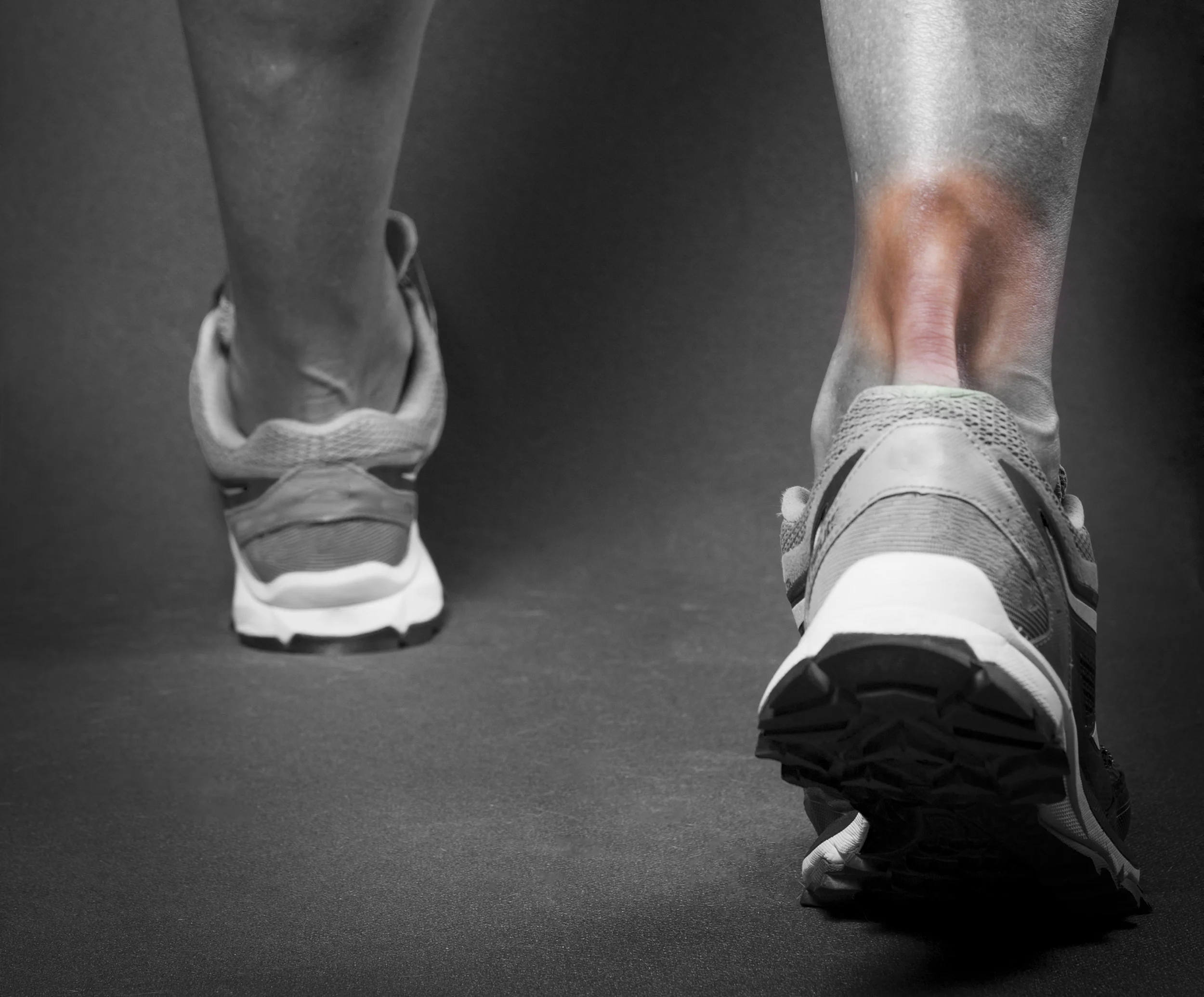Achilles-Tendonitis